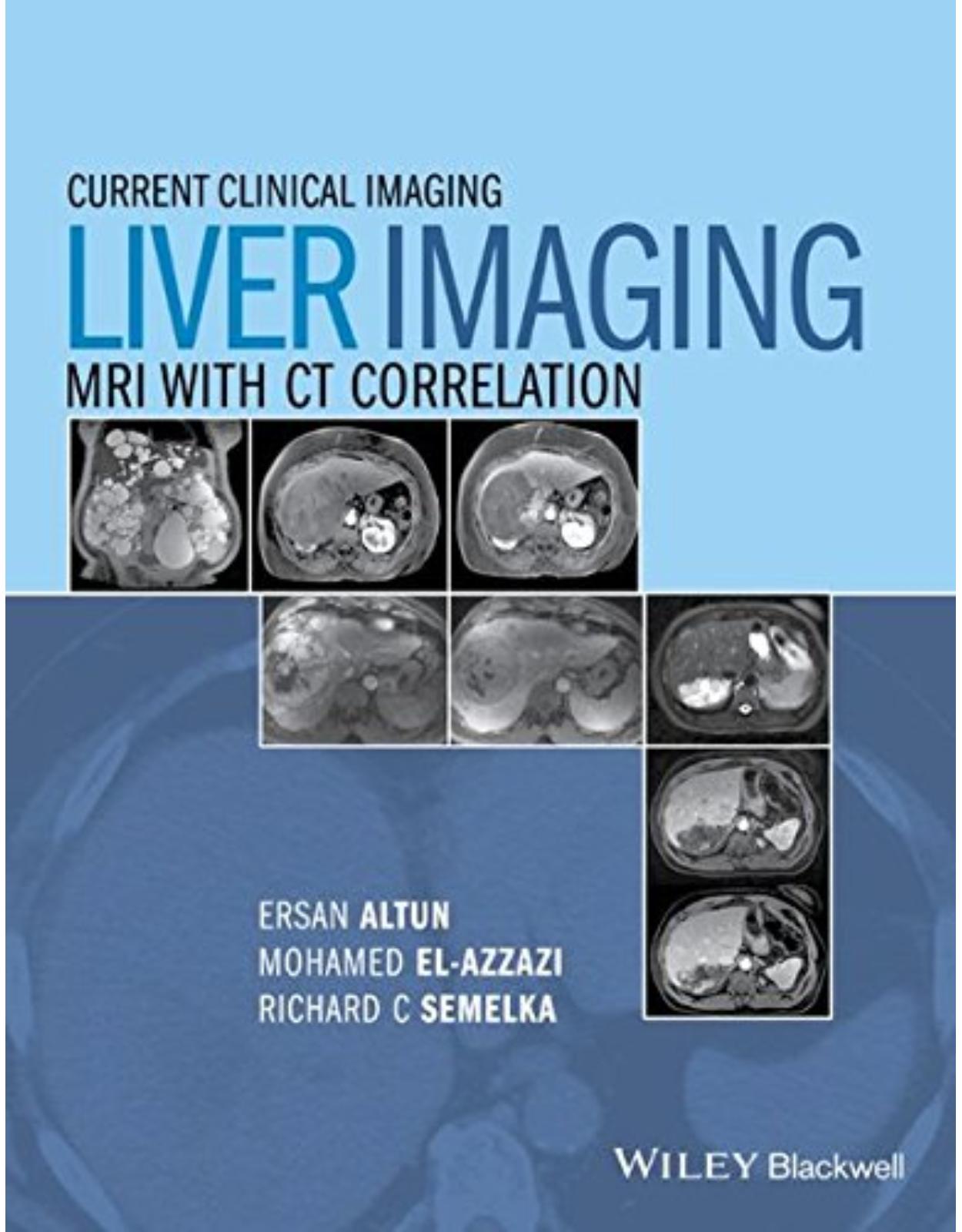 Liver Imaging: MRI with CT Correlation (Current Clinical Imaging)