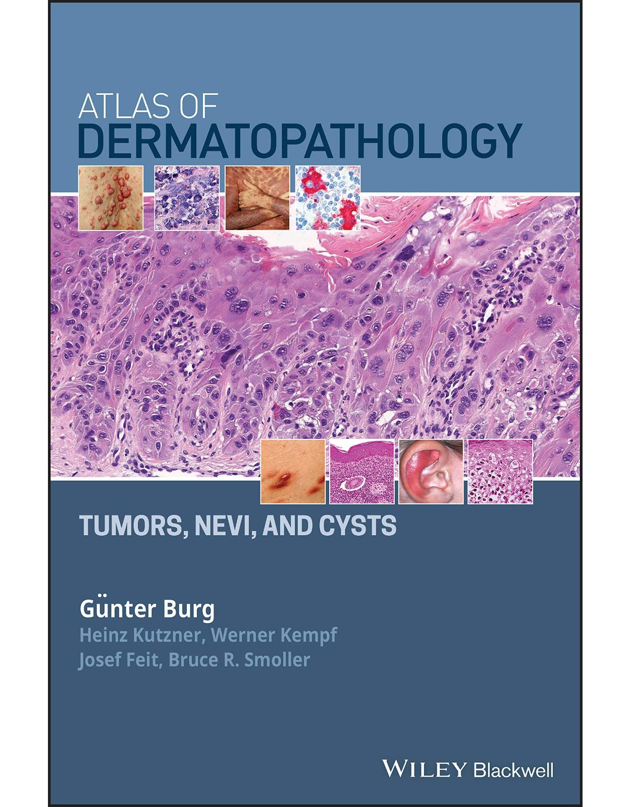 Atlas of Dermatopathology: Tumors, Nevi, and Cysts