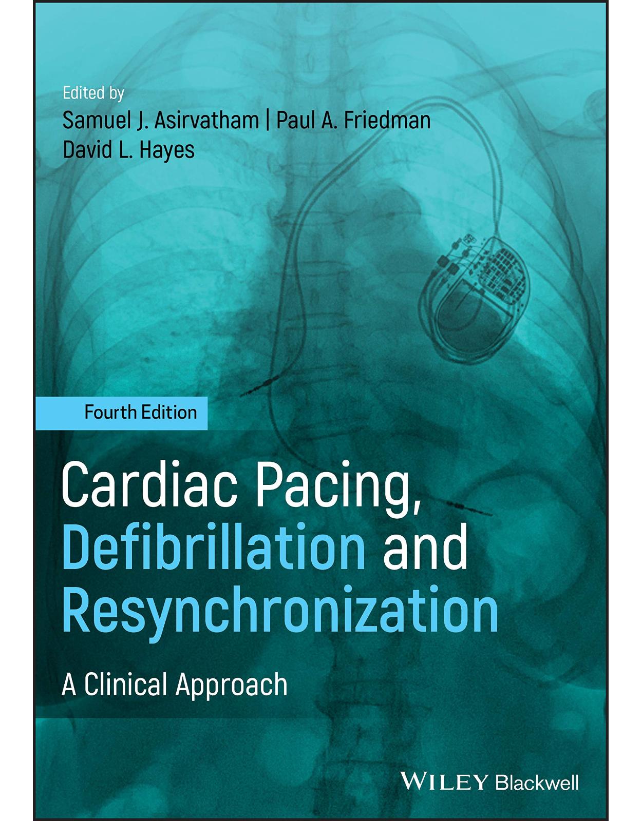 Cardiac Pacing, Defibrillation and Resynchronization