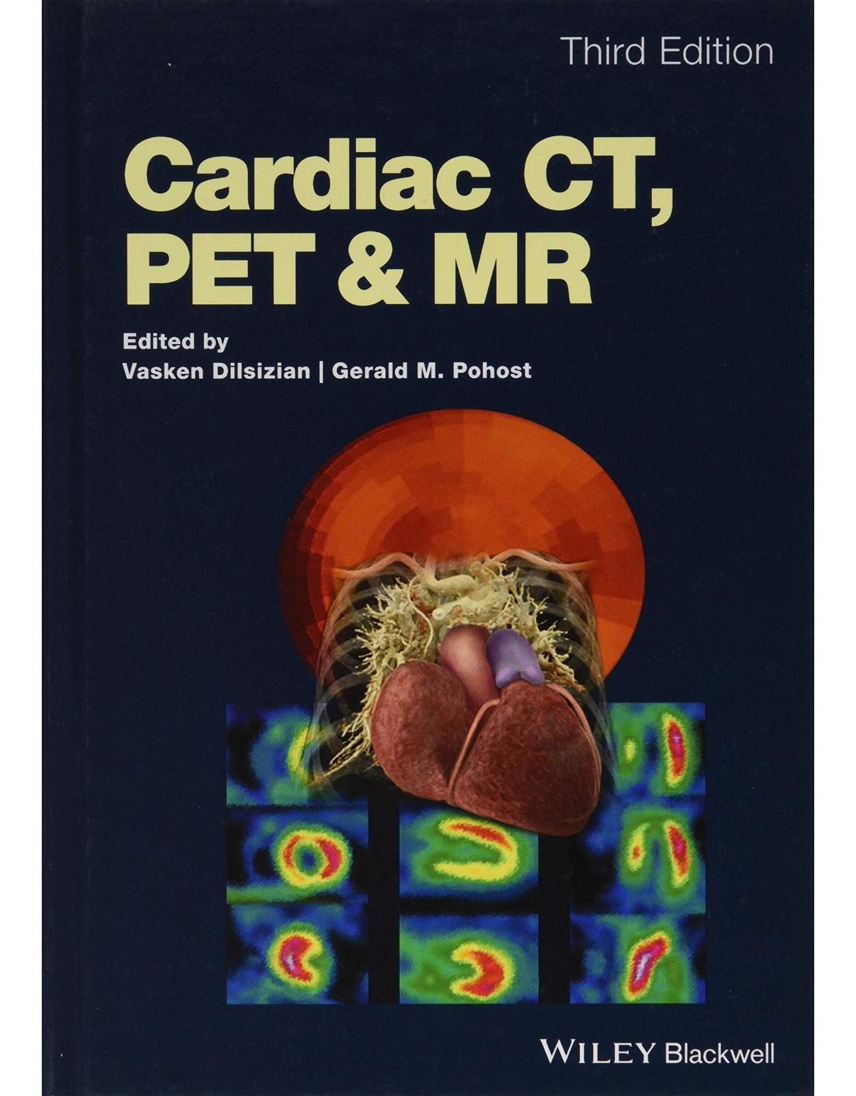 Cardiac CT, PET and MR