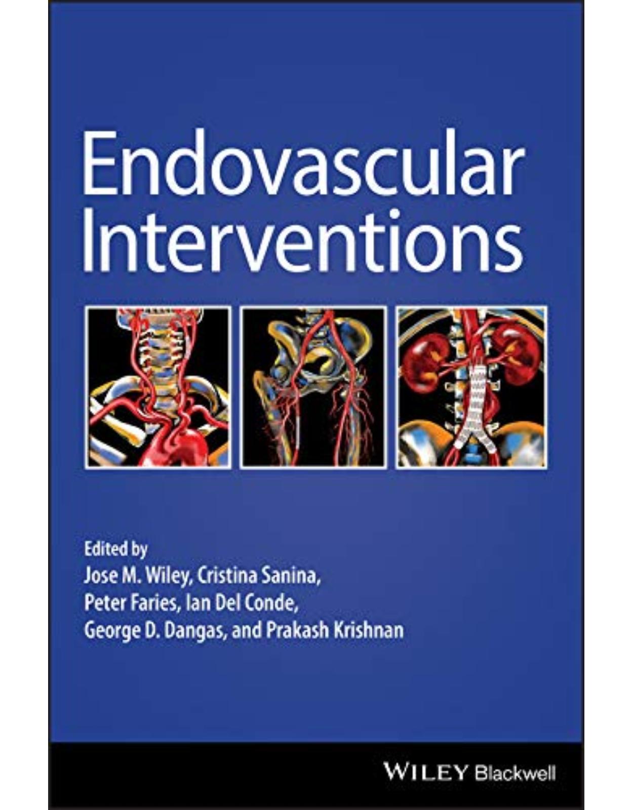 Endovascular Interventions