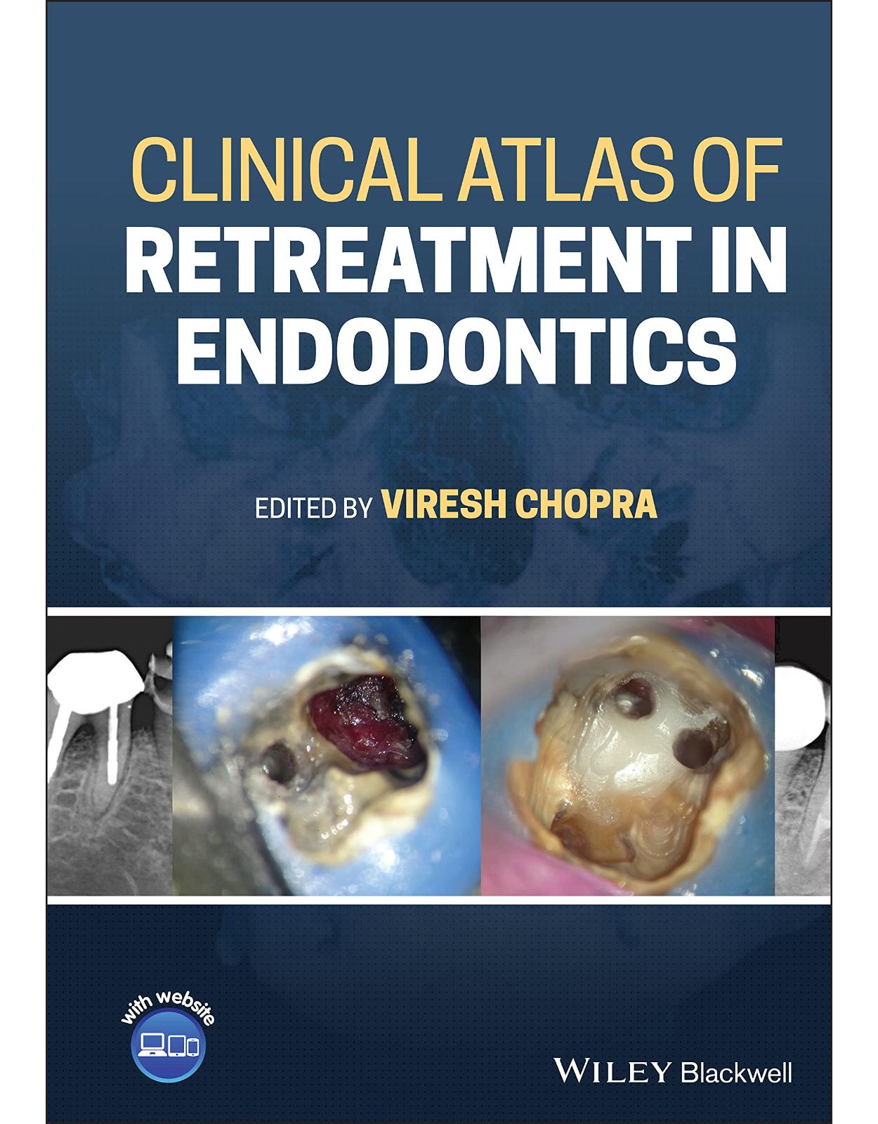 Clinical Atlas of Retreatment in Endodontics