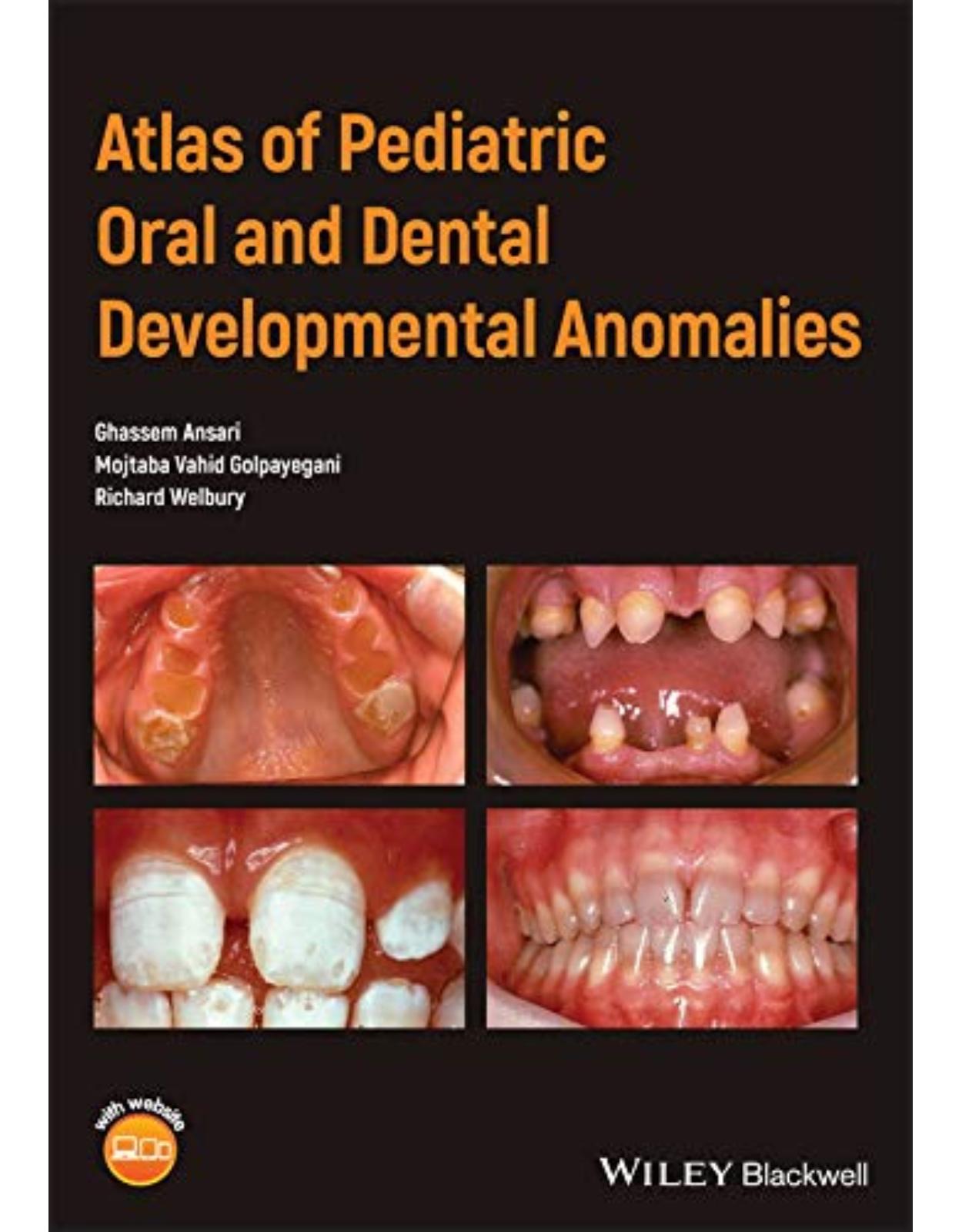 Atlas of Pediatric Oral and Dental Developmental Anomalies