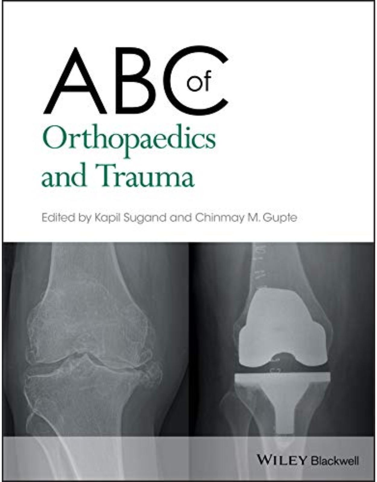 ABC of Orthopaedics and Trauma: 257 (ABC Series)