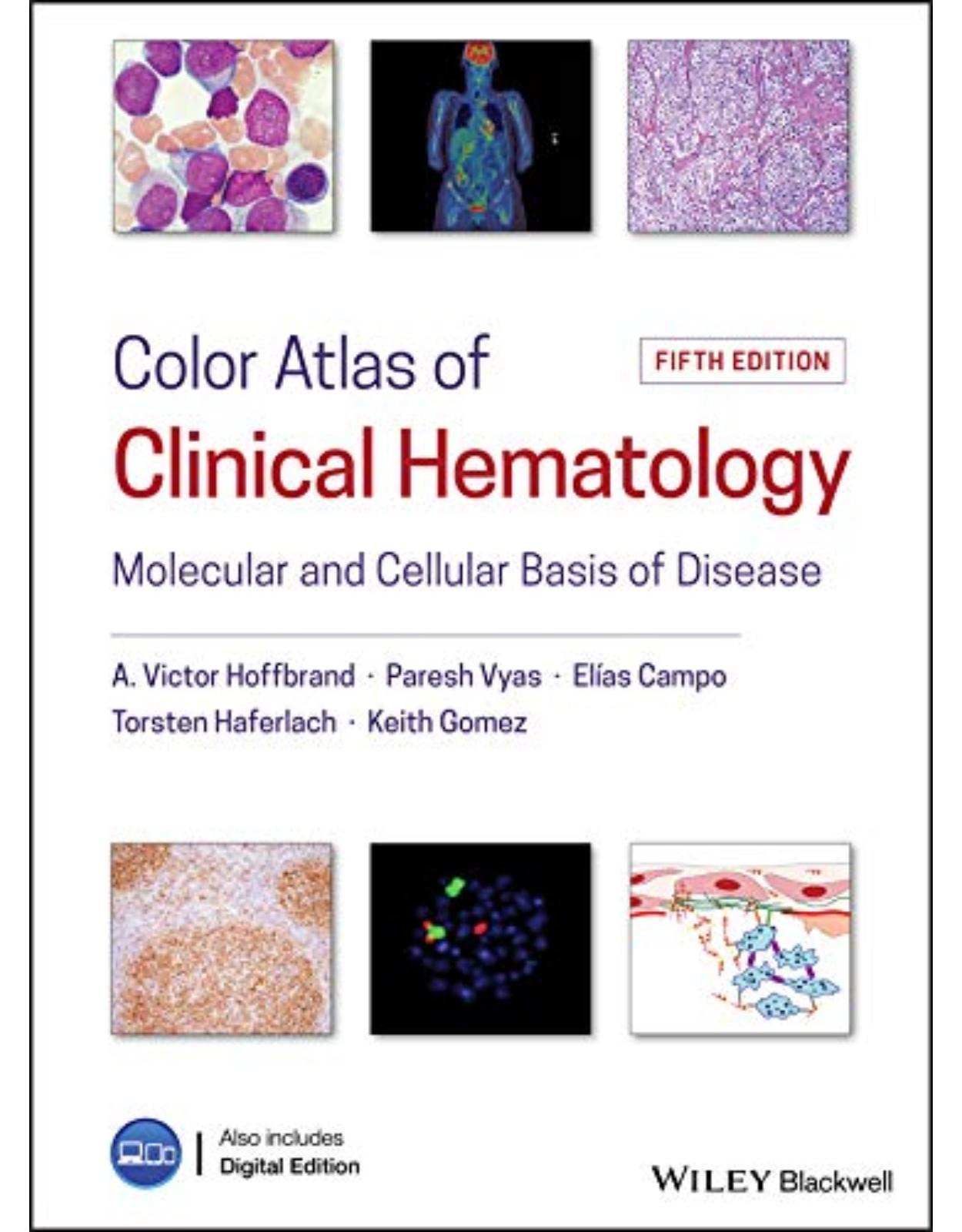 Color Atlas of Clinical Hematology: Molecular and Cellular Basis of Disease 