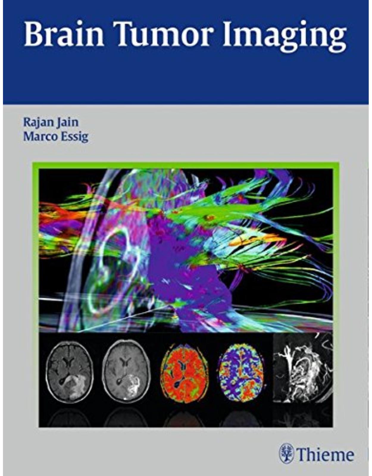 Brain Tumor Imaging