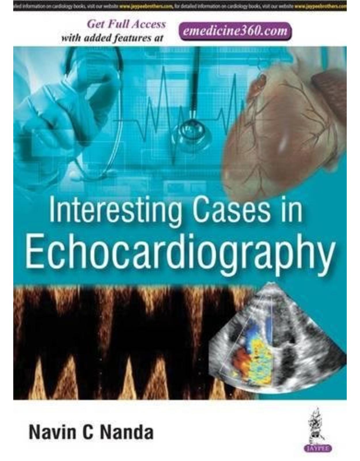 Interesting Cases in Echocardiography