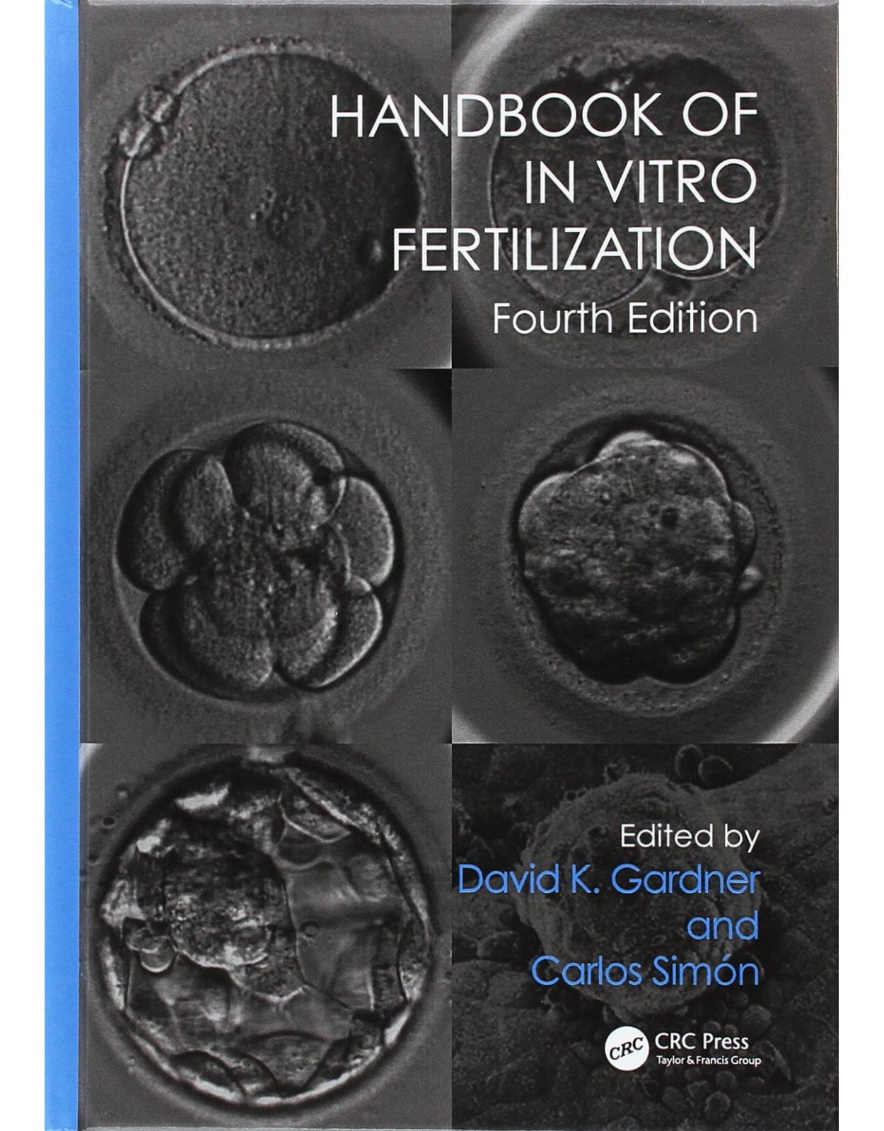 Handbook of In Vitro Fertilization, Fourth Edition