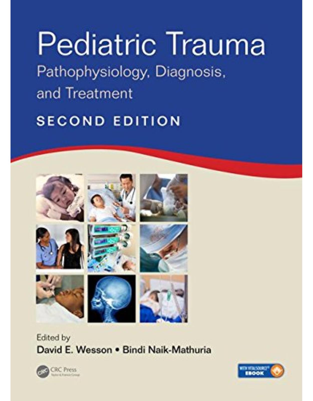 Pediatric Trauma: Pathophysiology, Diagnosis, and Treatment, Second Edition