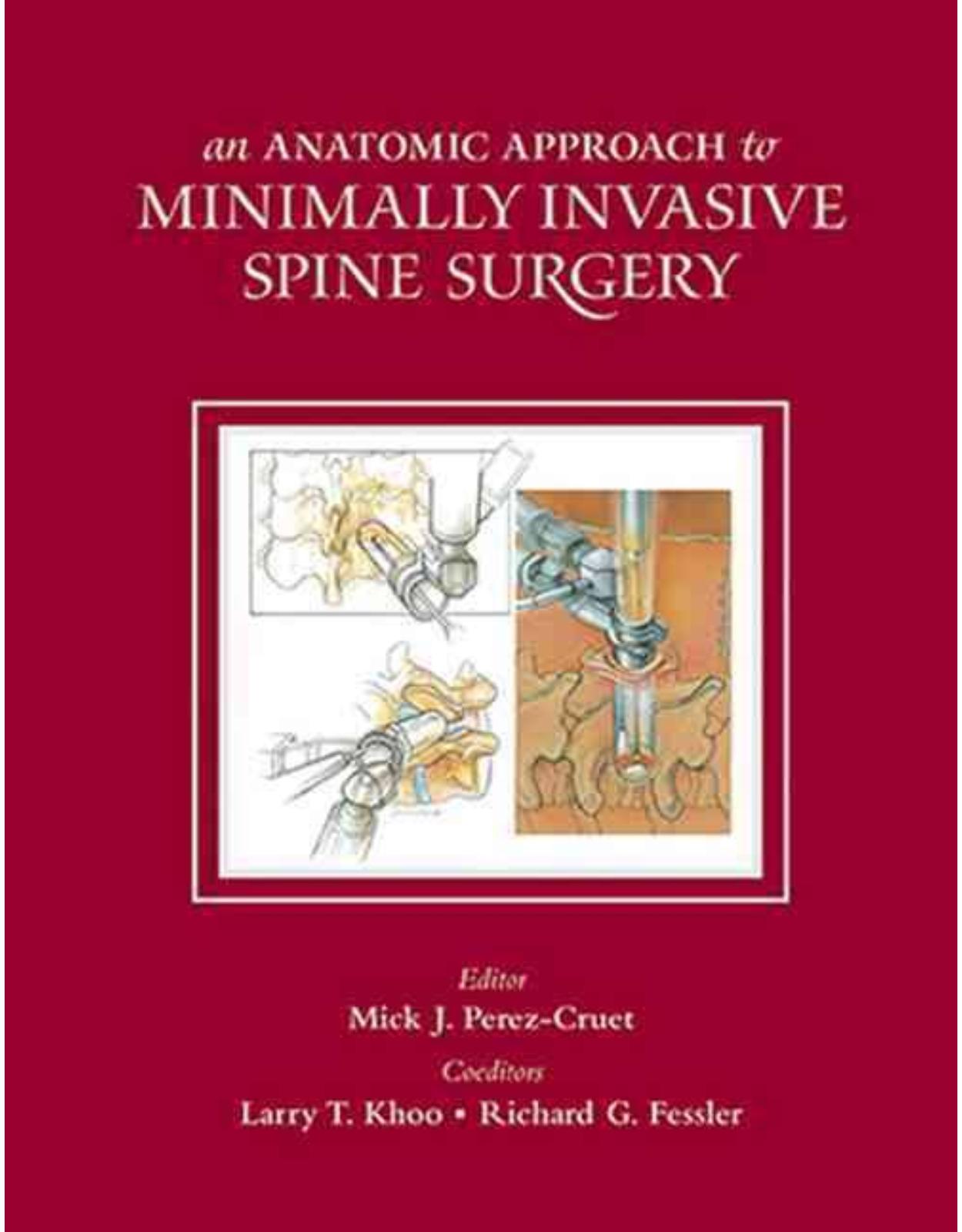 Anatomic Approach to Minimally Invasive Spine Surgery, Second Edition