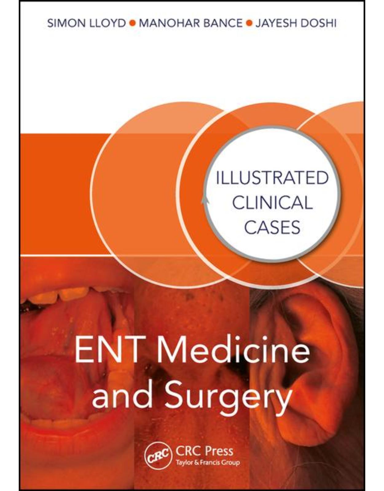 ENT Medicine and Surgery: Illustrated Clinical Cases