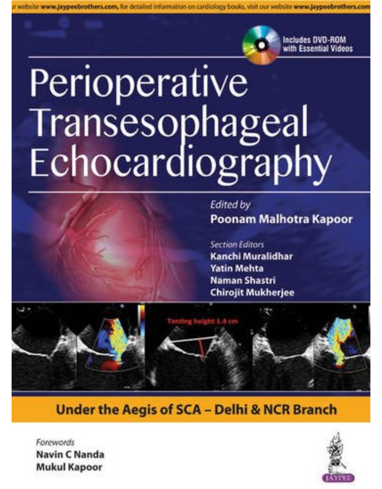 Perioperative Transeasophageal Echocardiography