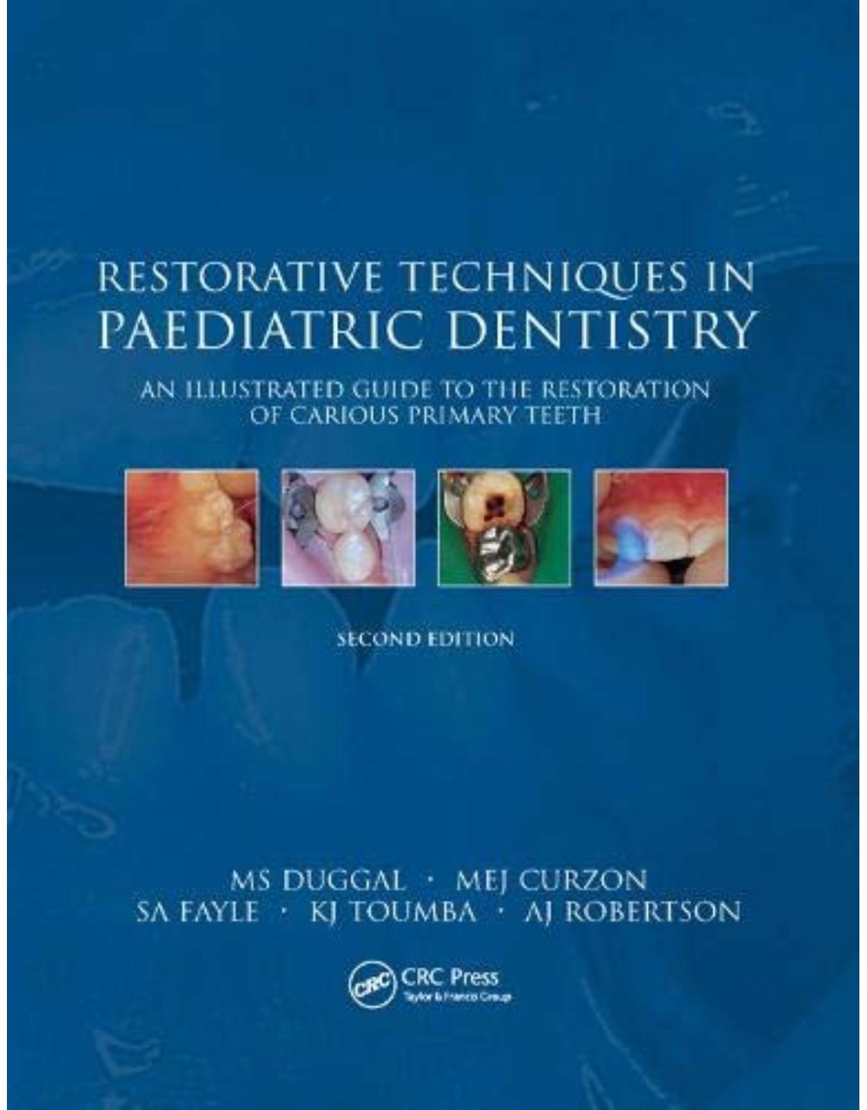 Restorative Techniques in Paediatric Dentistry: An Illustrated Guide to the Restoration of Extensive Carious Primary Teeth