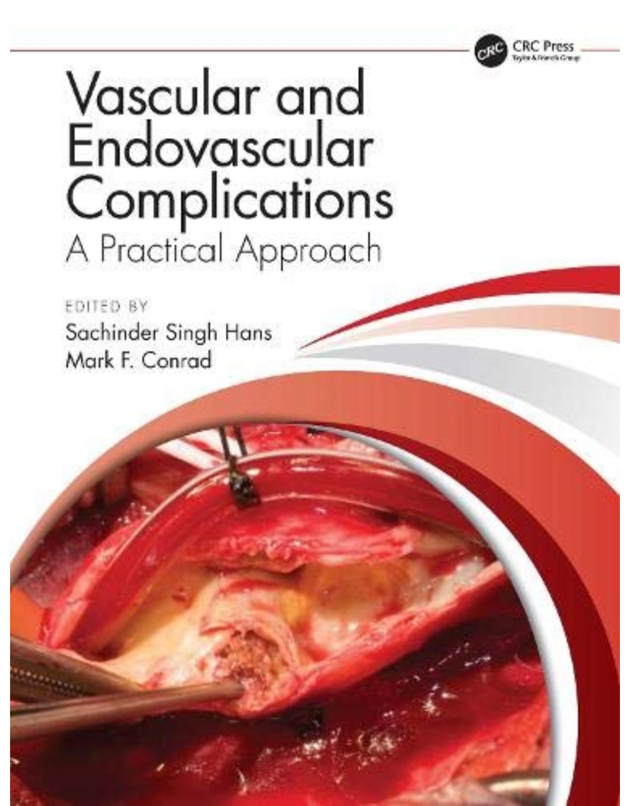 Vascular and Endovascular Complications: A Practical Approach