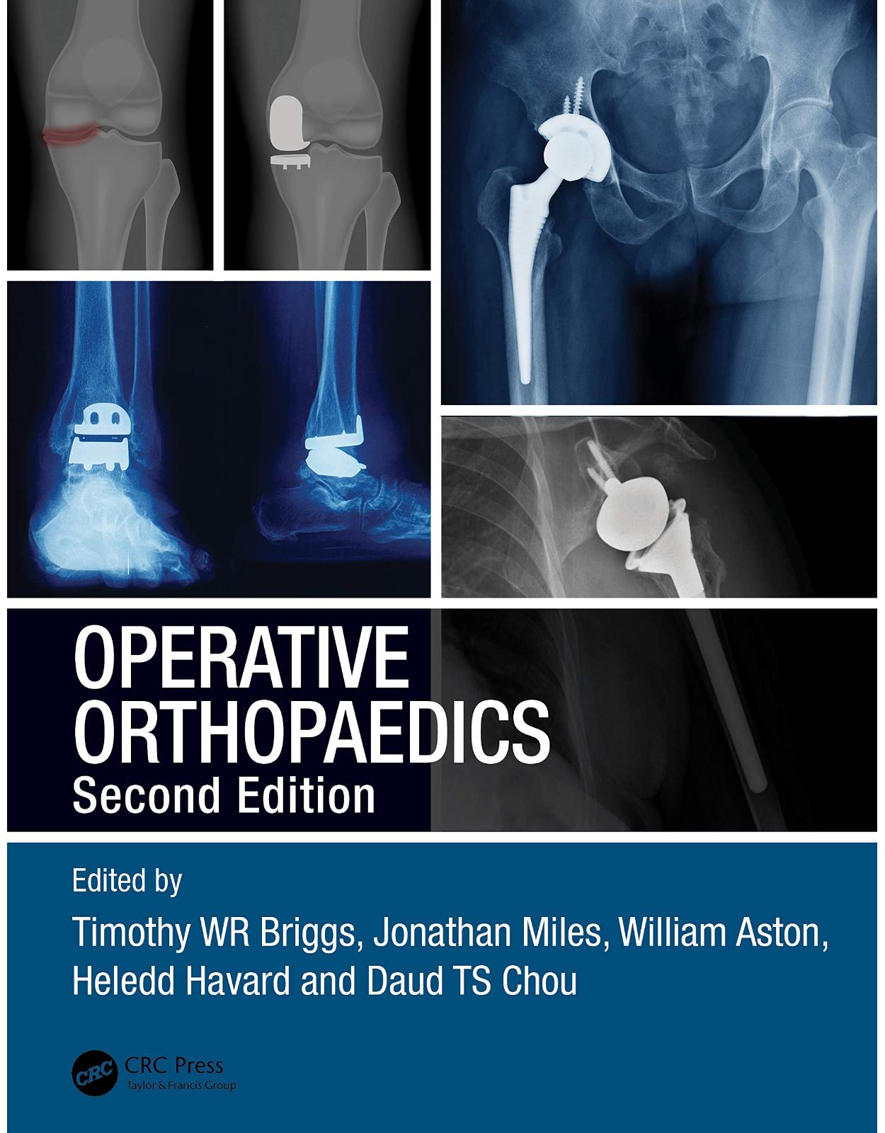 Operative Orthopaedics