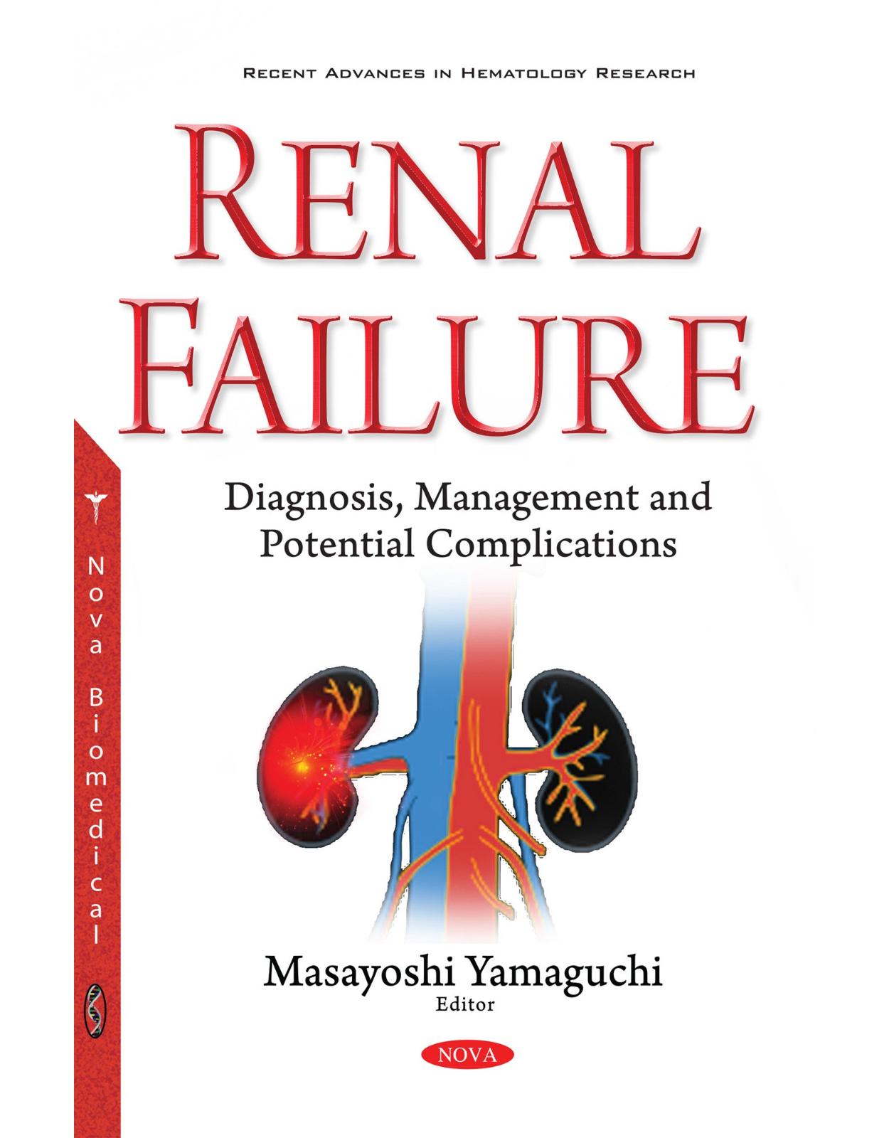 Renal Failure: Diagnosis, Management & Potential Complications