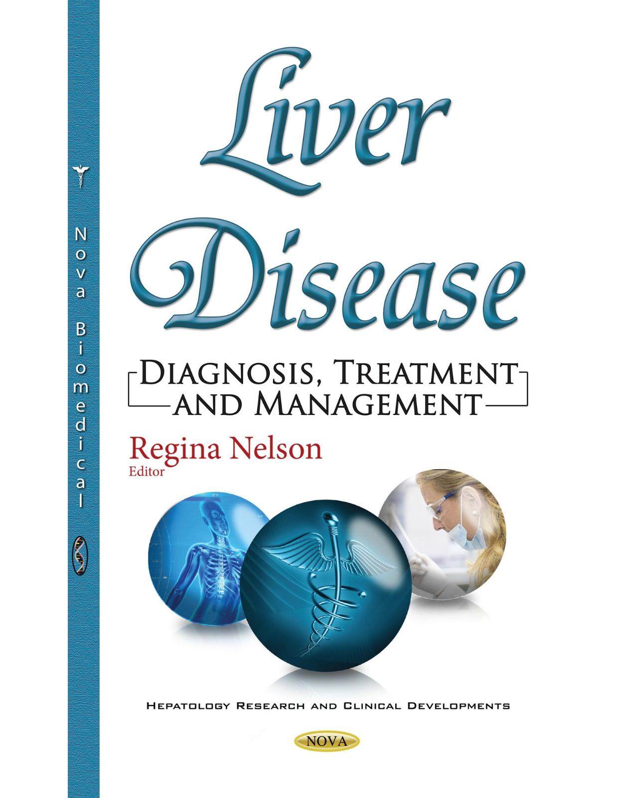 Liver Disease: Diagnosis, Treatment & Management