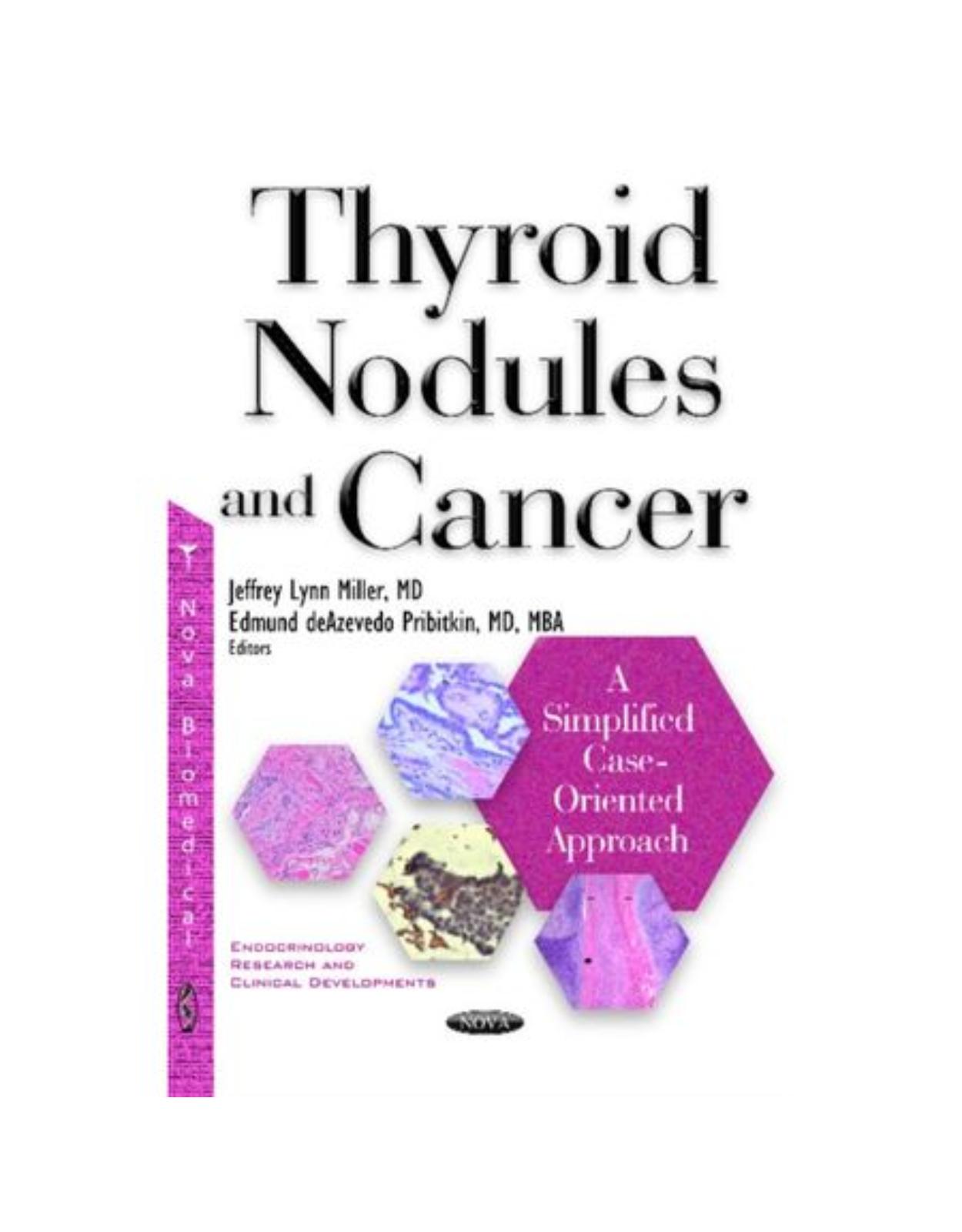 Thyroid Nodules & Cancer: A Simplified Case Oriented Approach