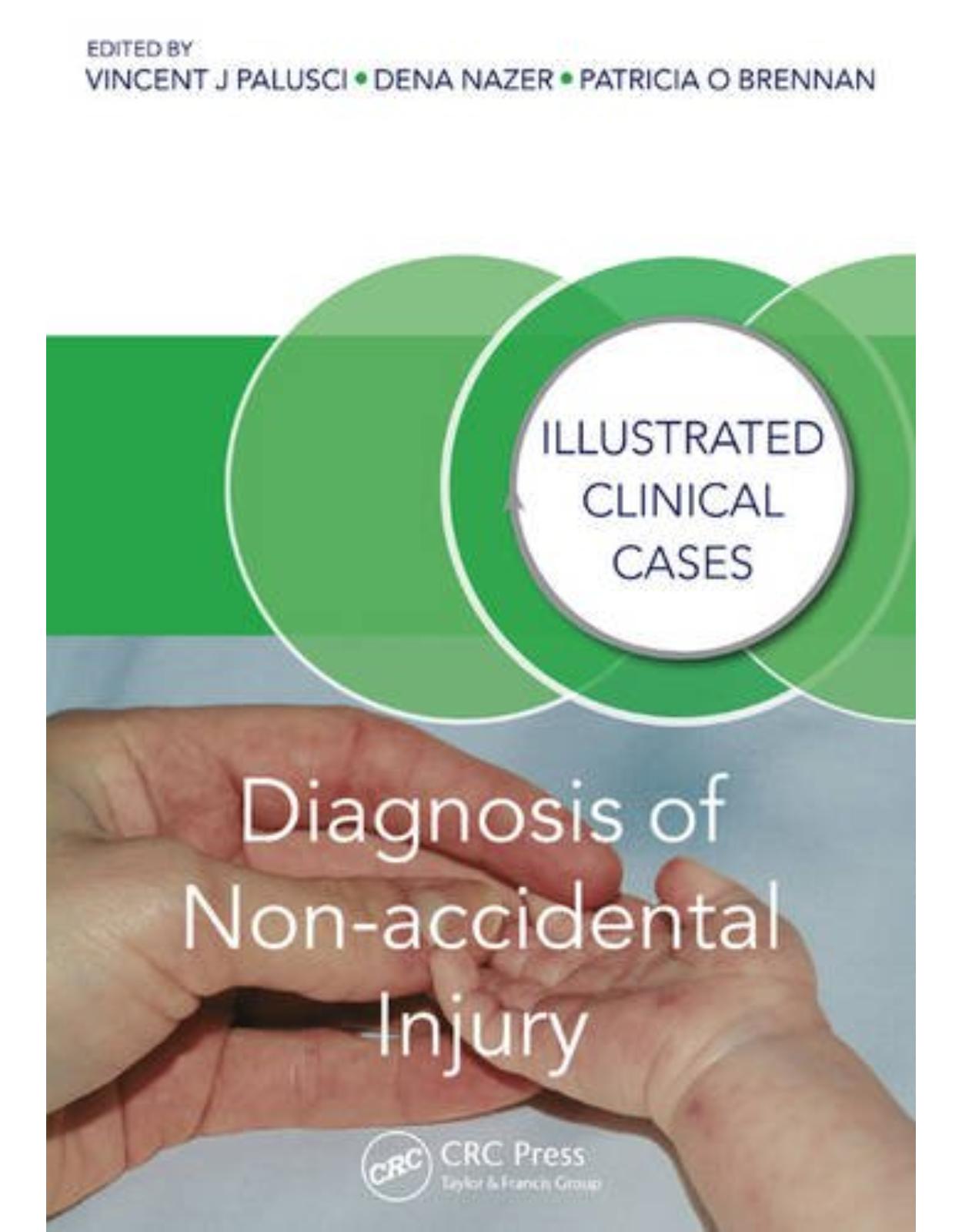 Diagnosis of Non-accidental Injury