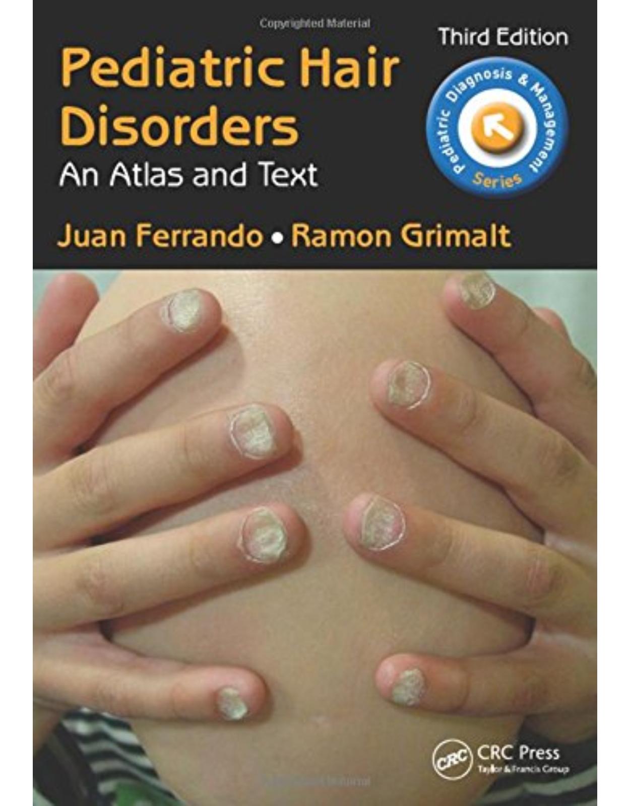 Pediatric Hair Disorders