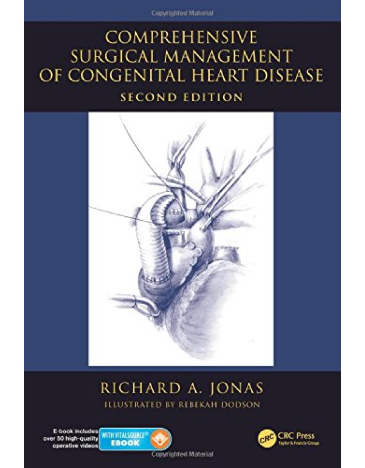 Comprehensive Surgical Management of Congenital Heart Disease, Second Edition