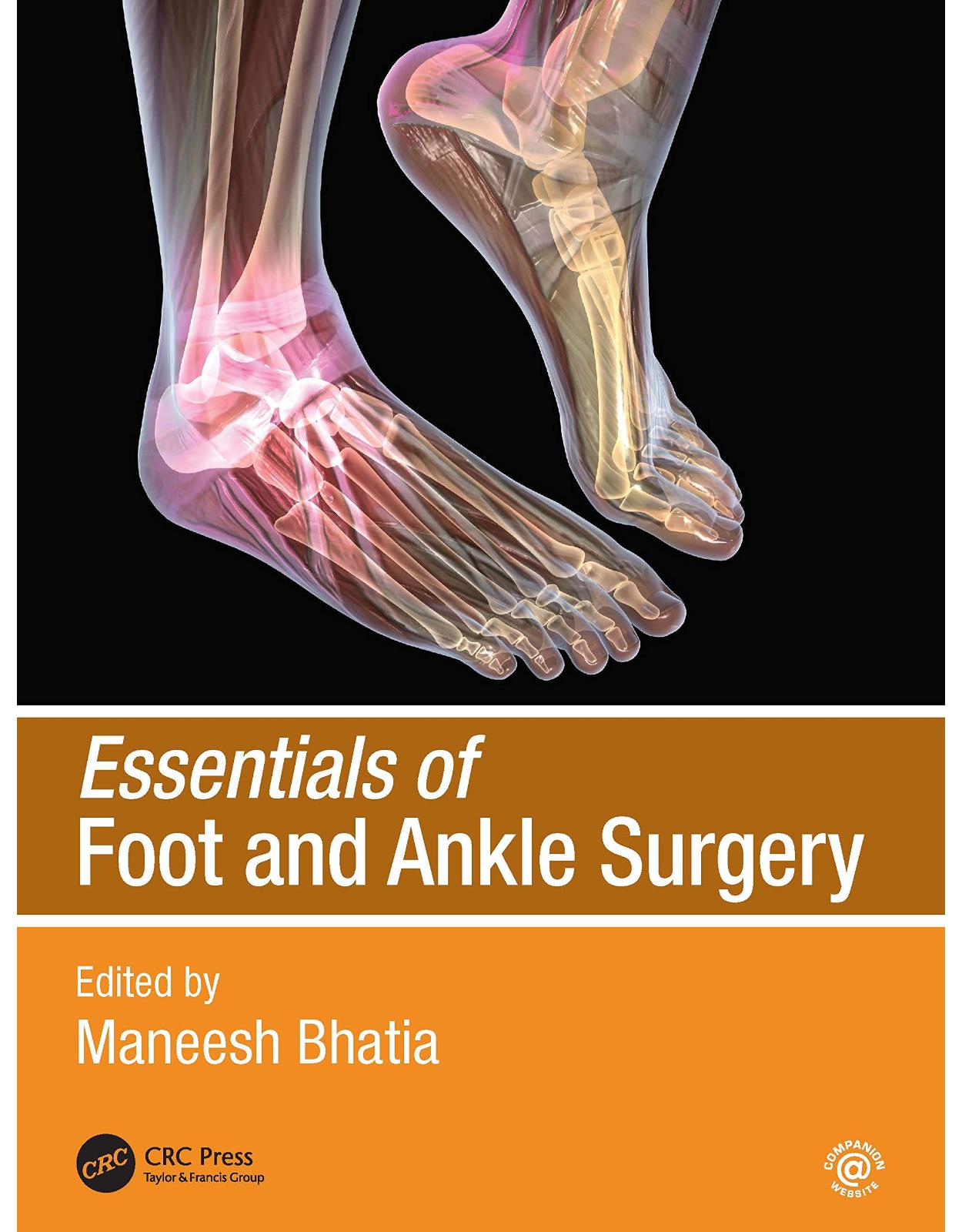 Essentials of Foot and Ankle Surgery