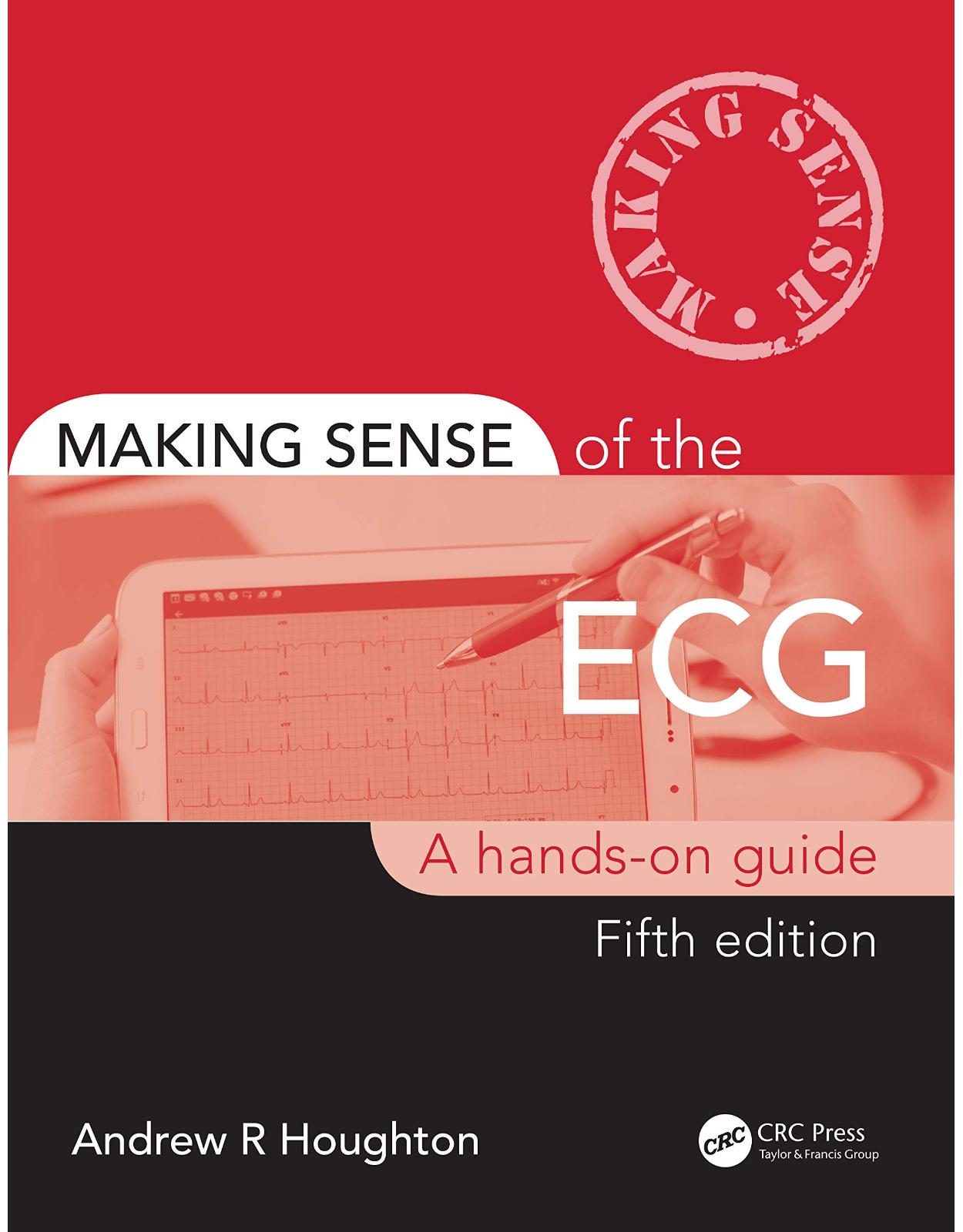 Making Sense of the ECG: A Hands-On Guide