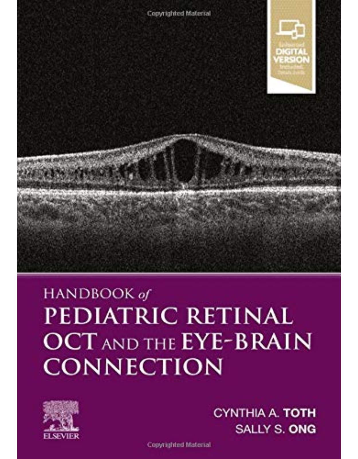 Handbook of Pediatric Retinal OCT and the Eye-Brain Connection 