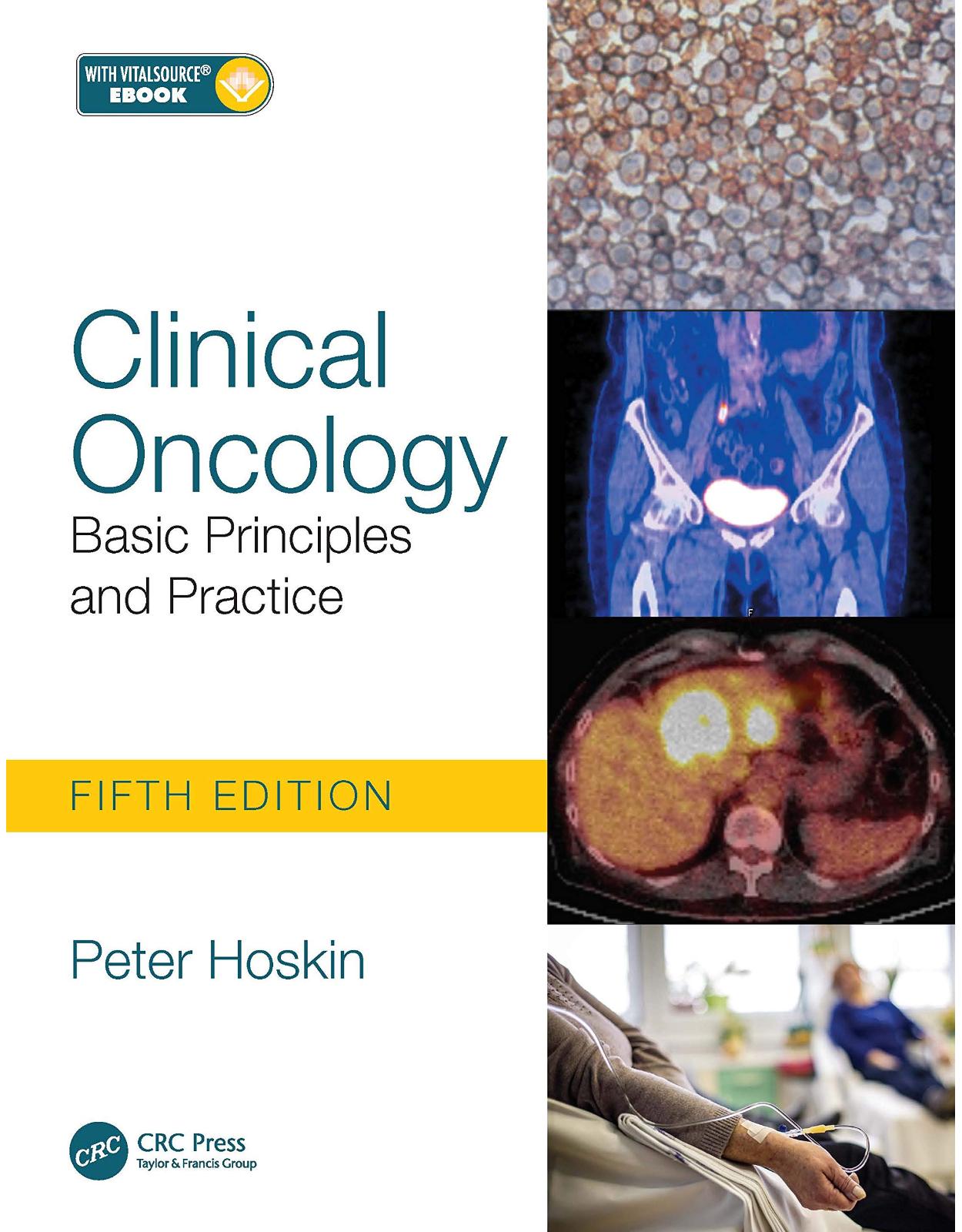 Clinical Oncology: Basic Principles and Practice 