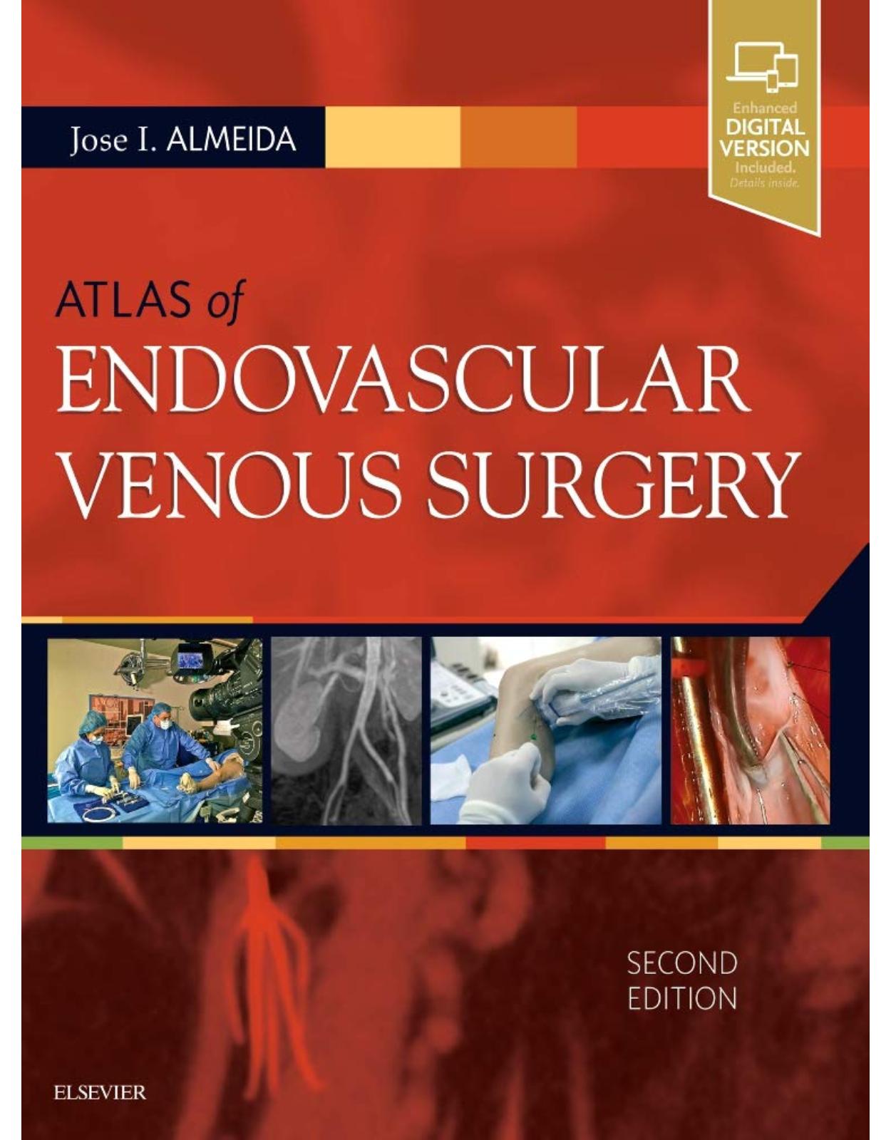 Atlas of Endovascular Venous Surgery, 2e 