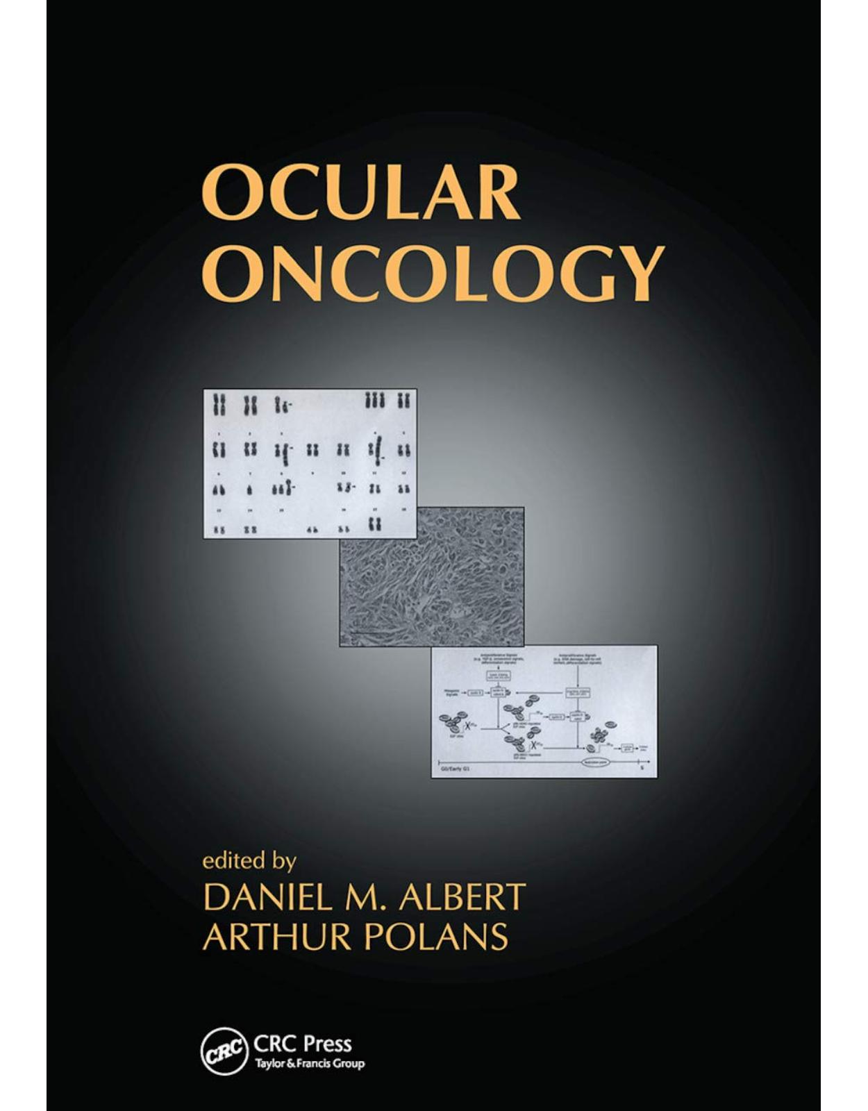 Ocular Oncology