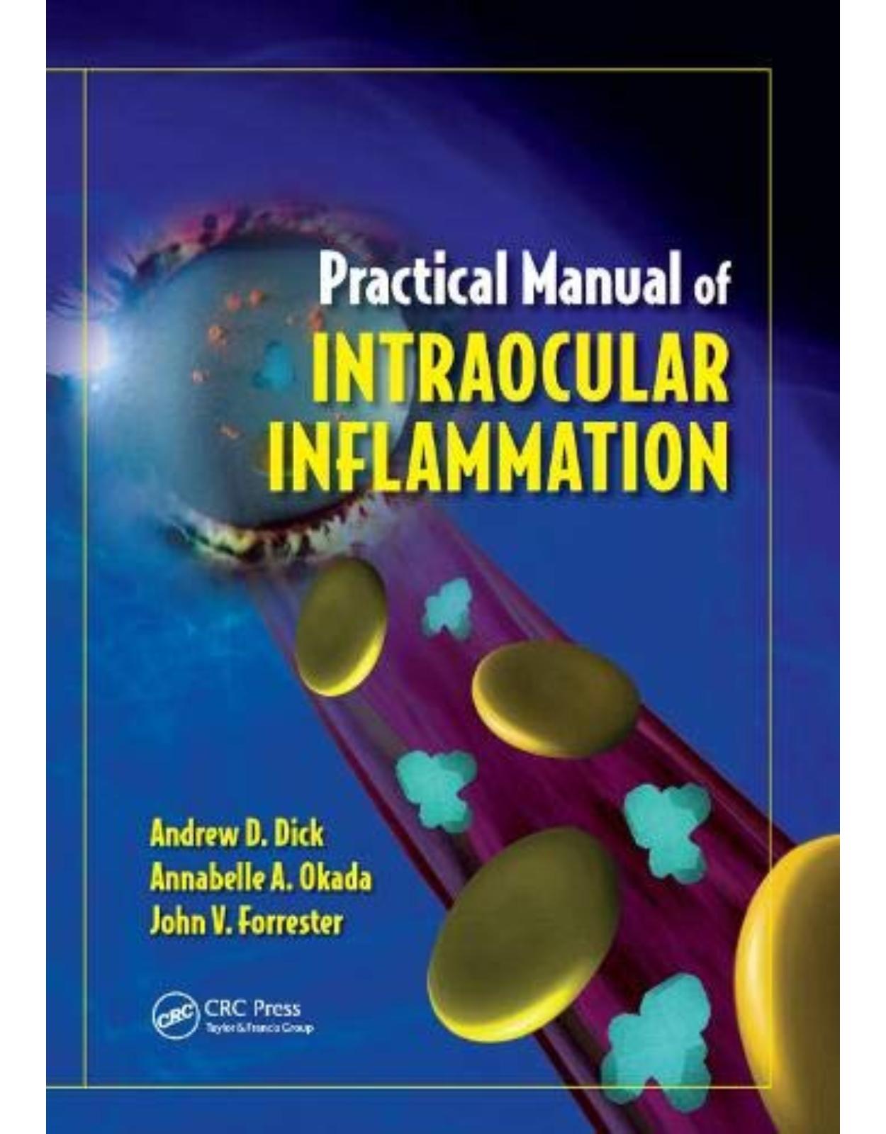 Practical Manual of Intraocular Inflammation