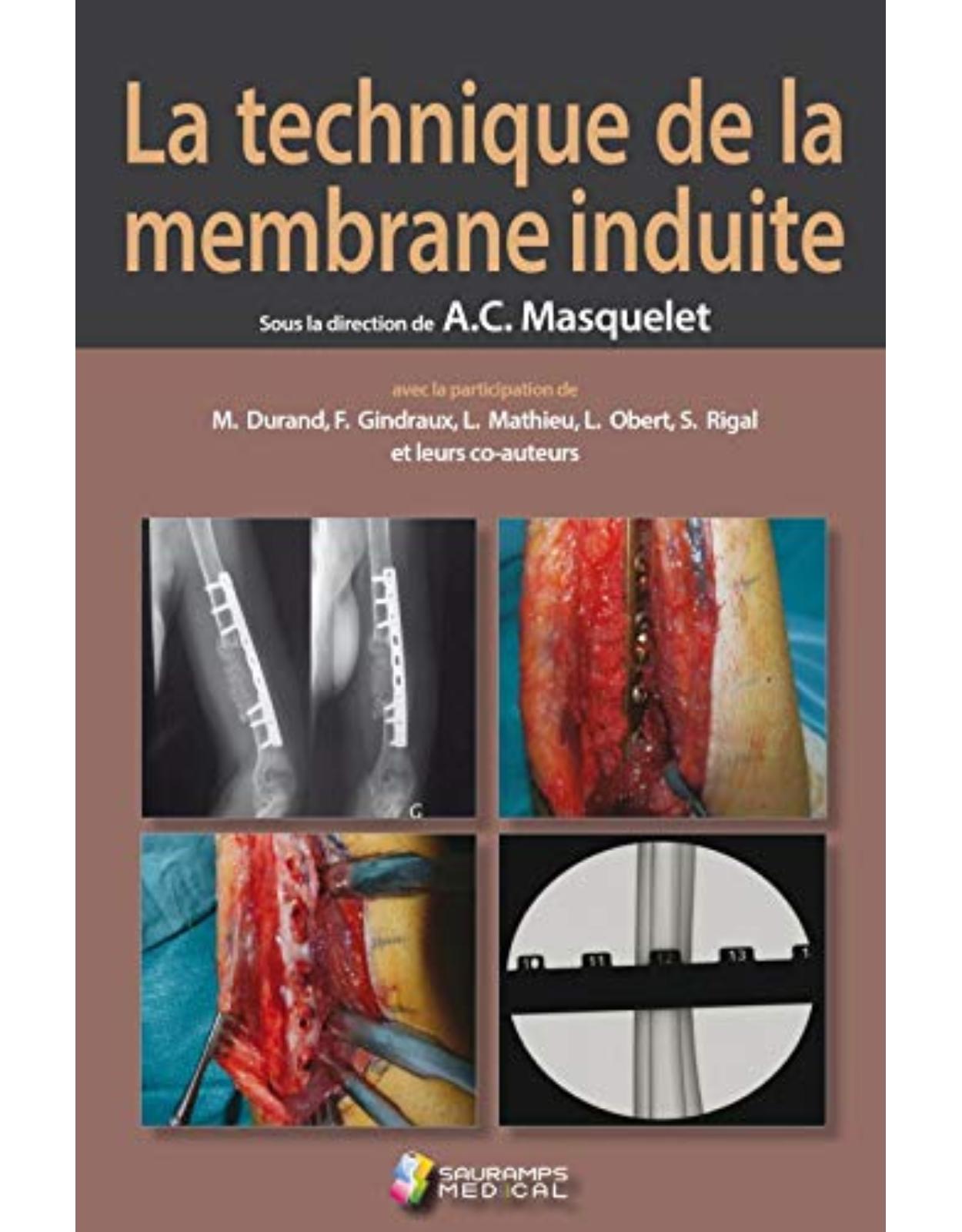 LA TECHNIQUE DE LA MEMBRANE INDUITE