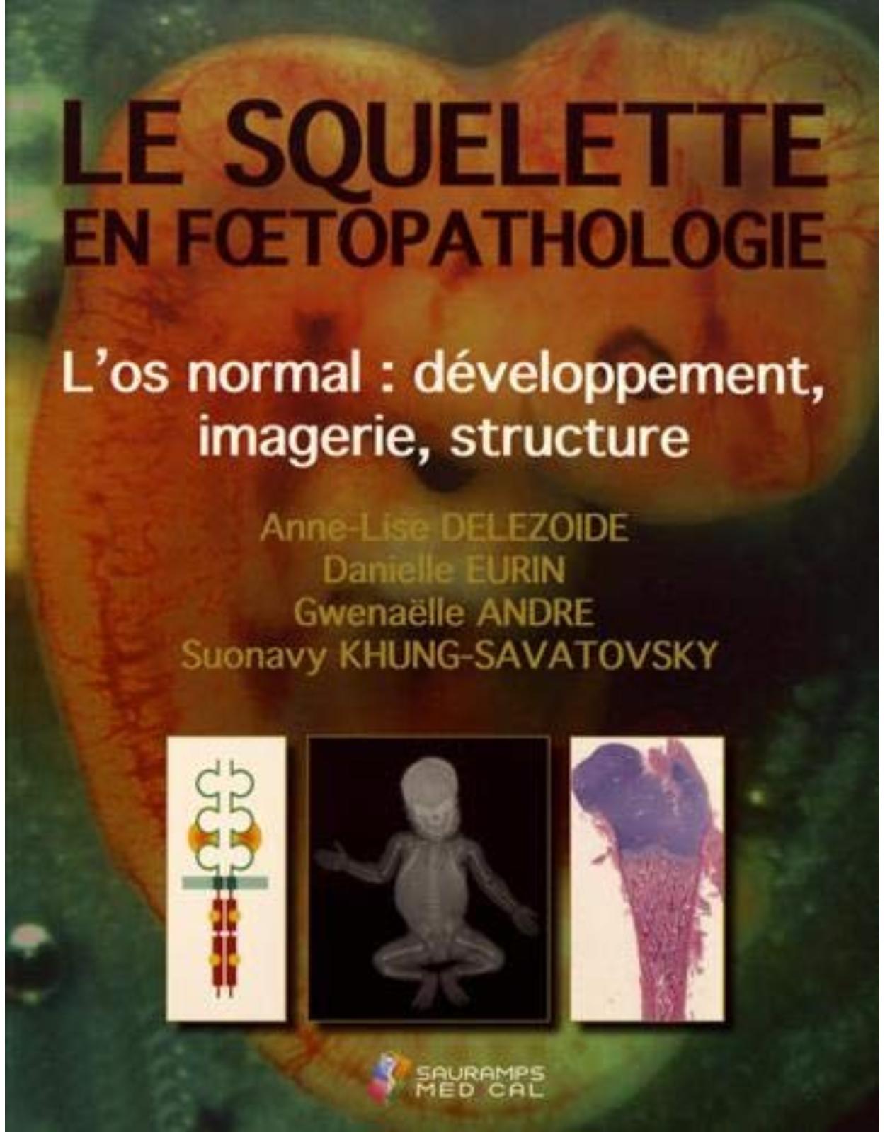 LE SQUELETTE EN FOETOPATHOLOGIE