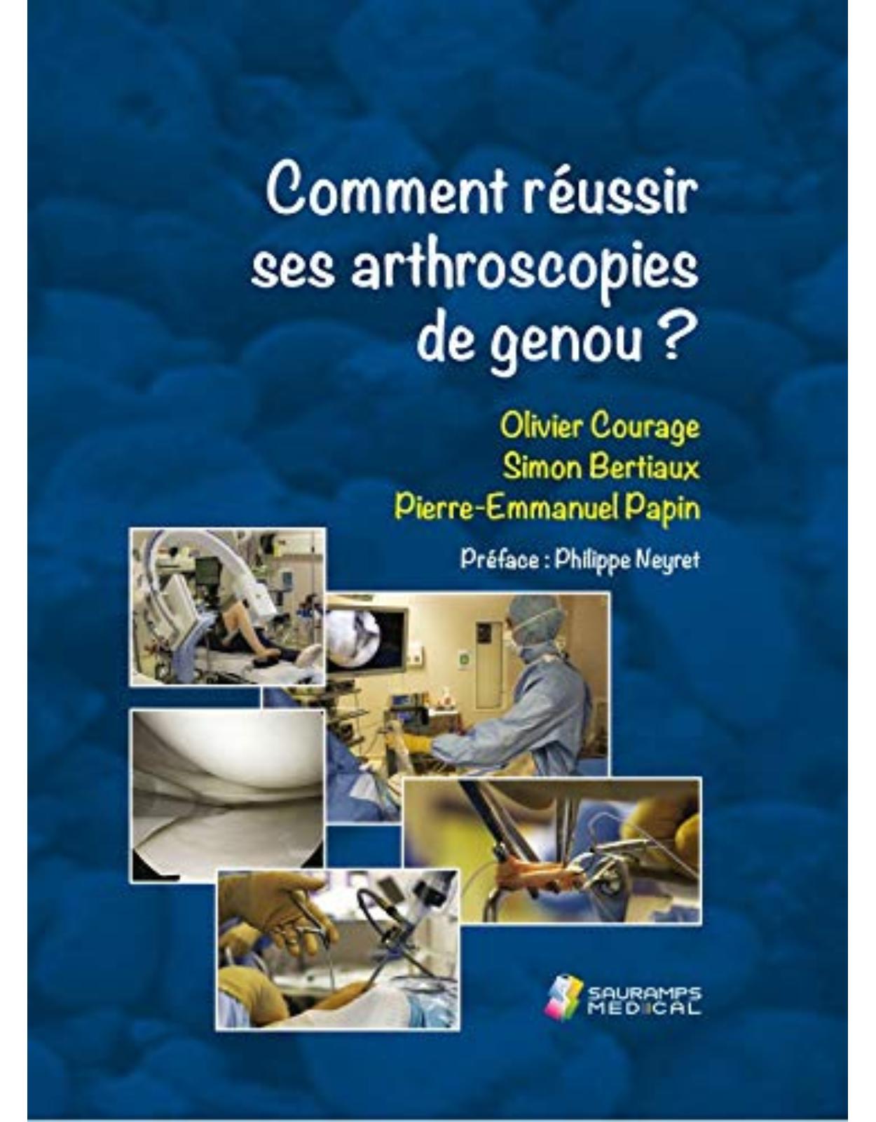 COMMENT REUSSIR SES ARTHROSCOPIES DE GENOU ?