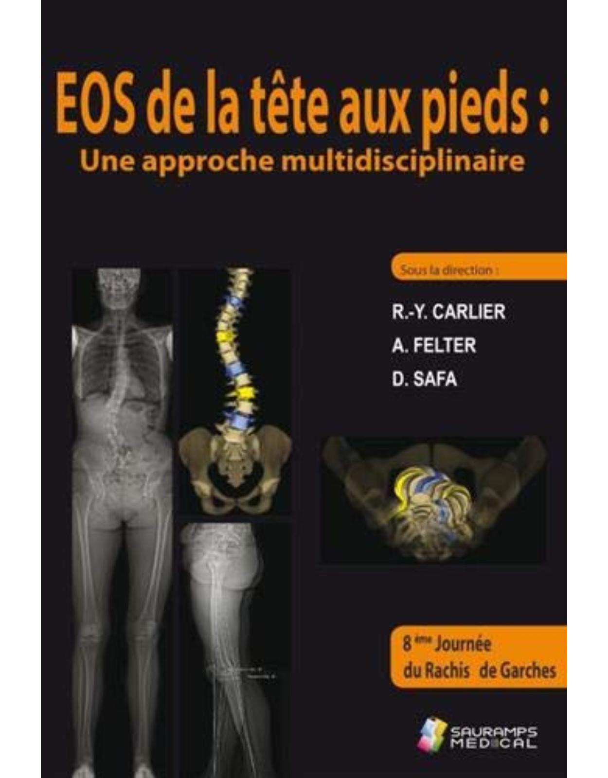 EOS DE LA TETE AUX PIEDS