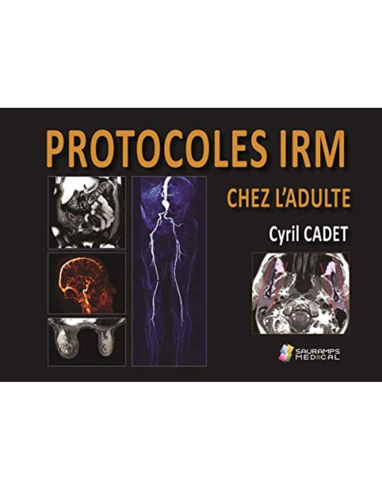 PROTOCOLES IRM CHEZ L'ADULTE