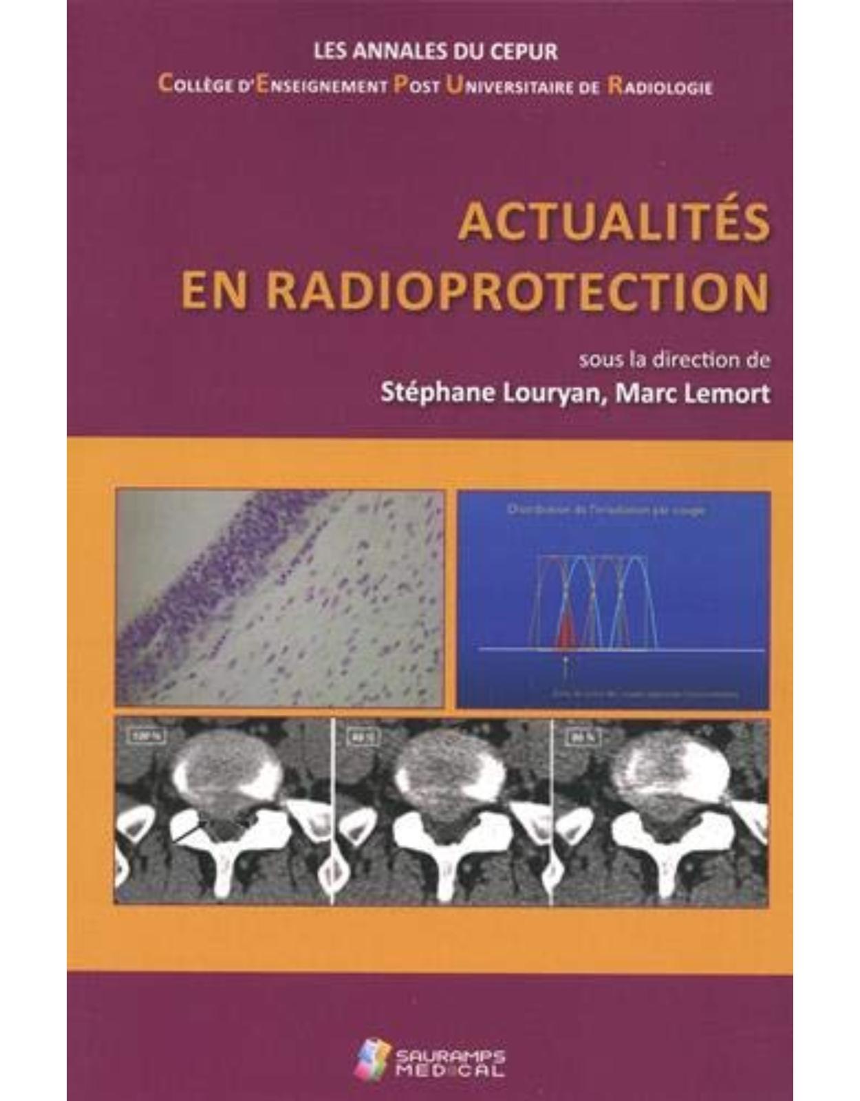 ACTUALITES EN RADIOPROTECTION