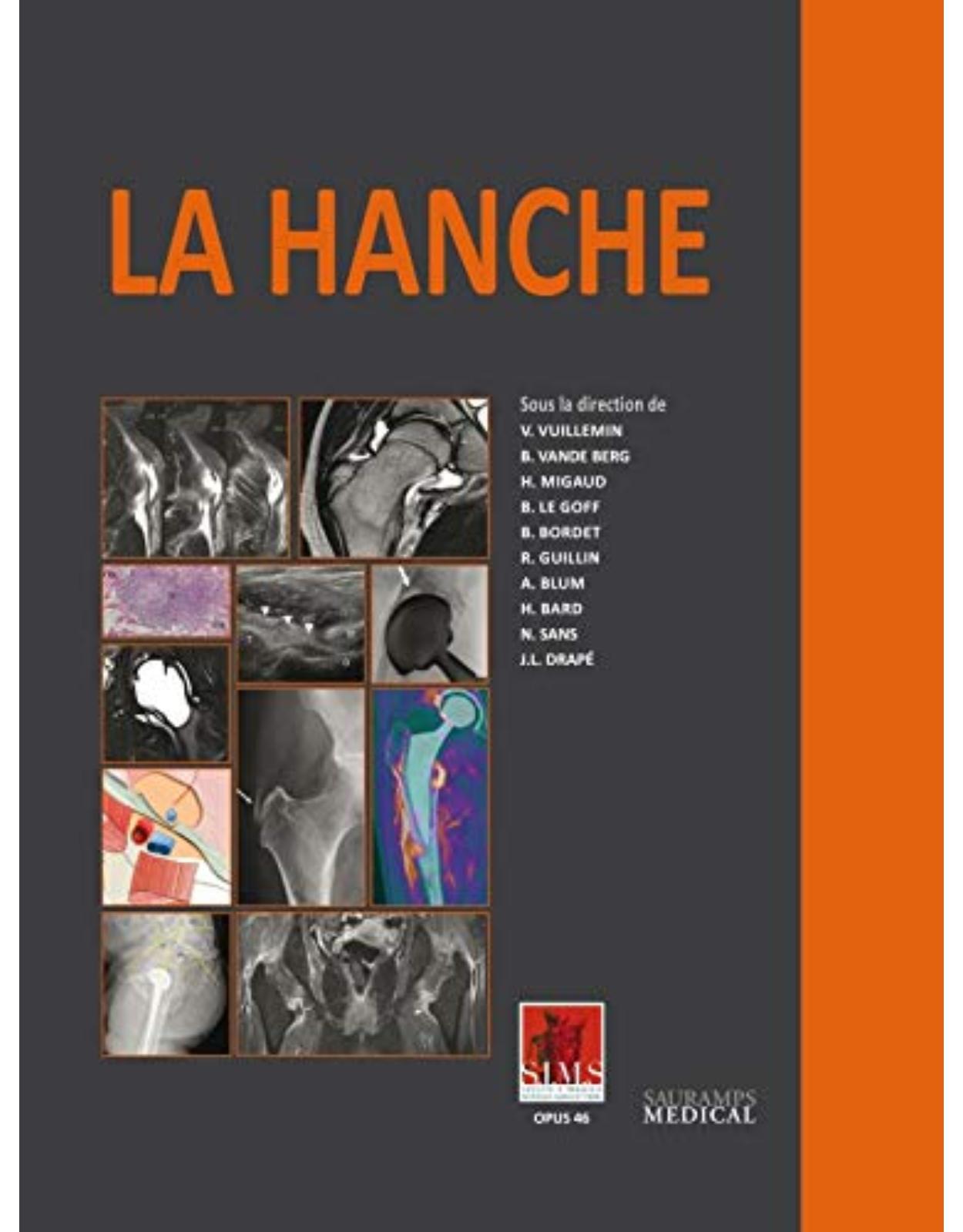 LA HANCHE