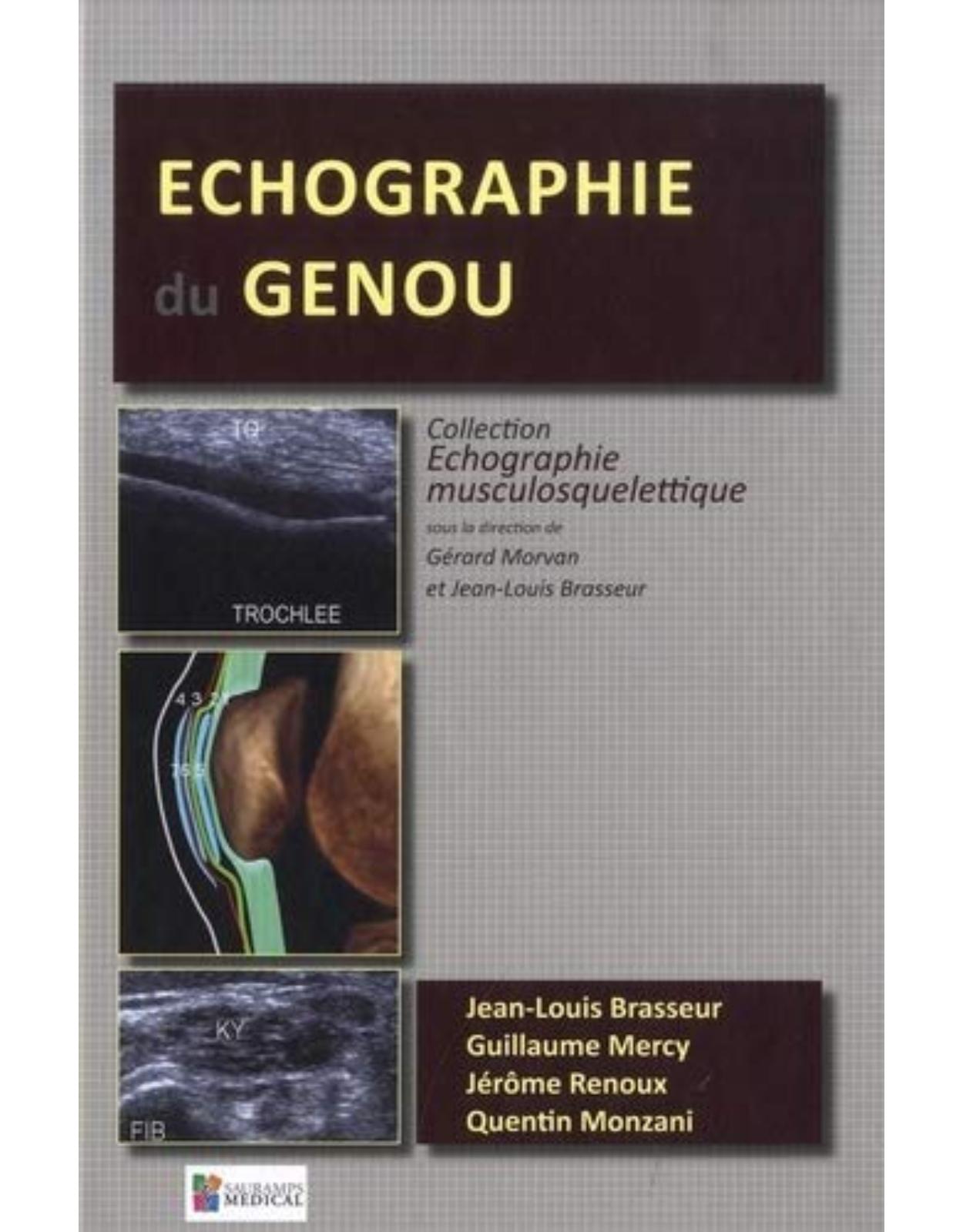 ECHOGRAPHIE DU GENOU