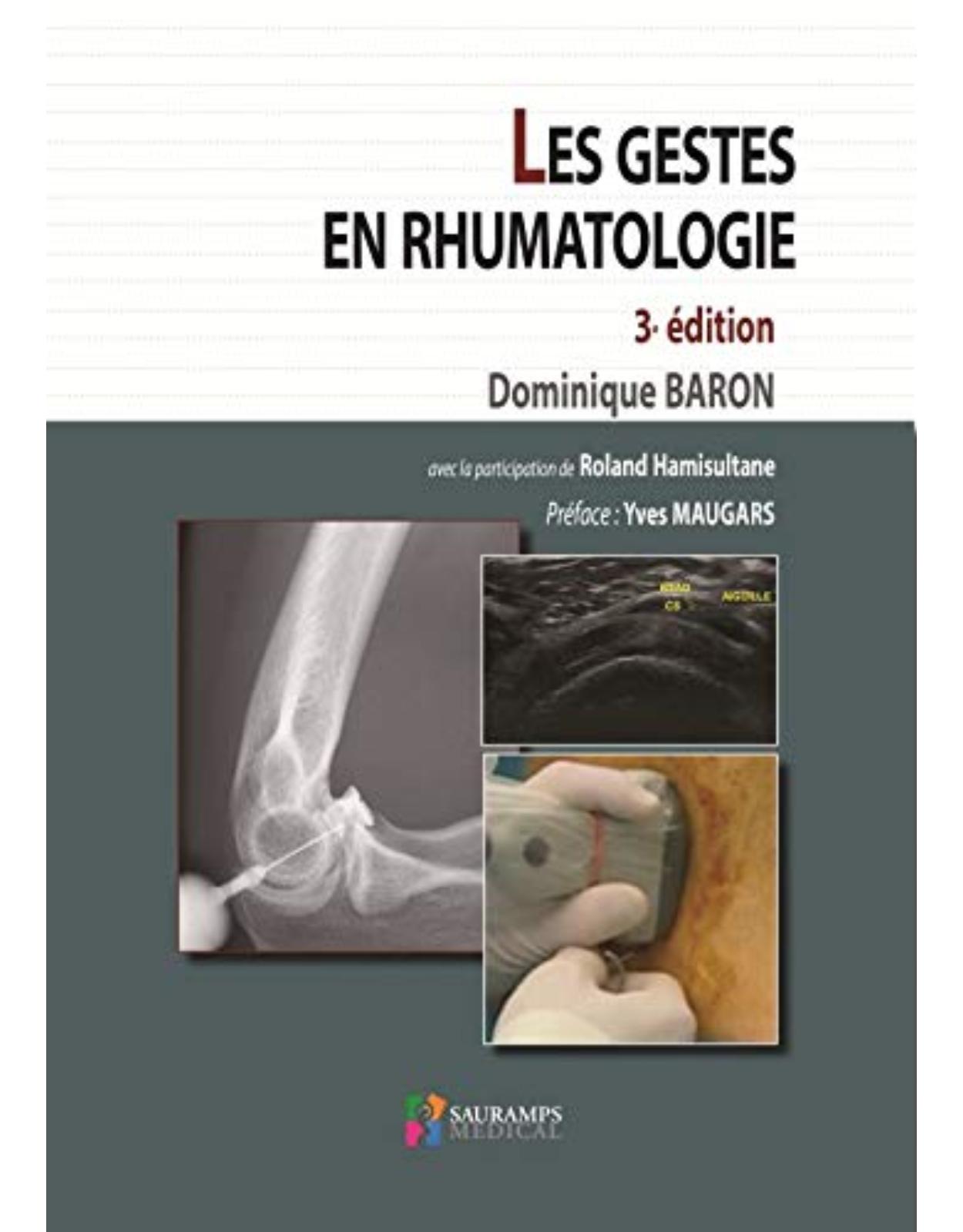 LES GESTES EN RHUMATOLOGIE 3�EDITION