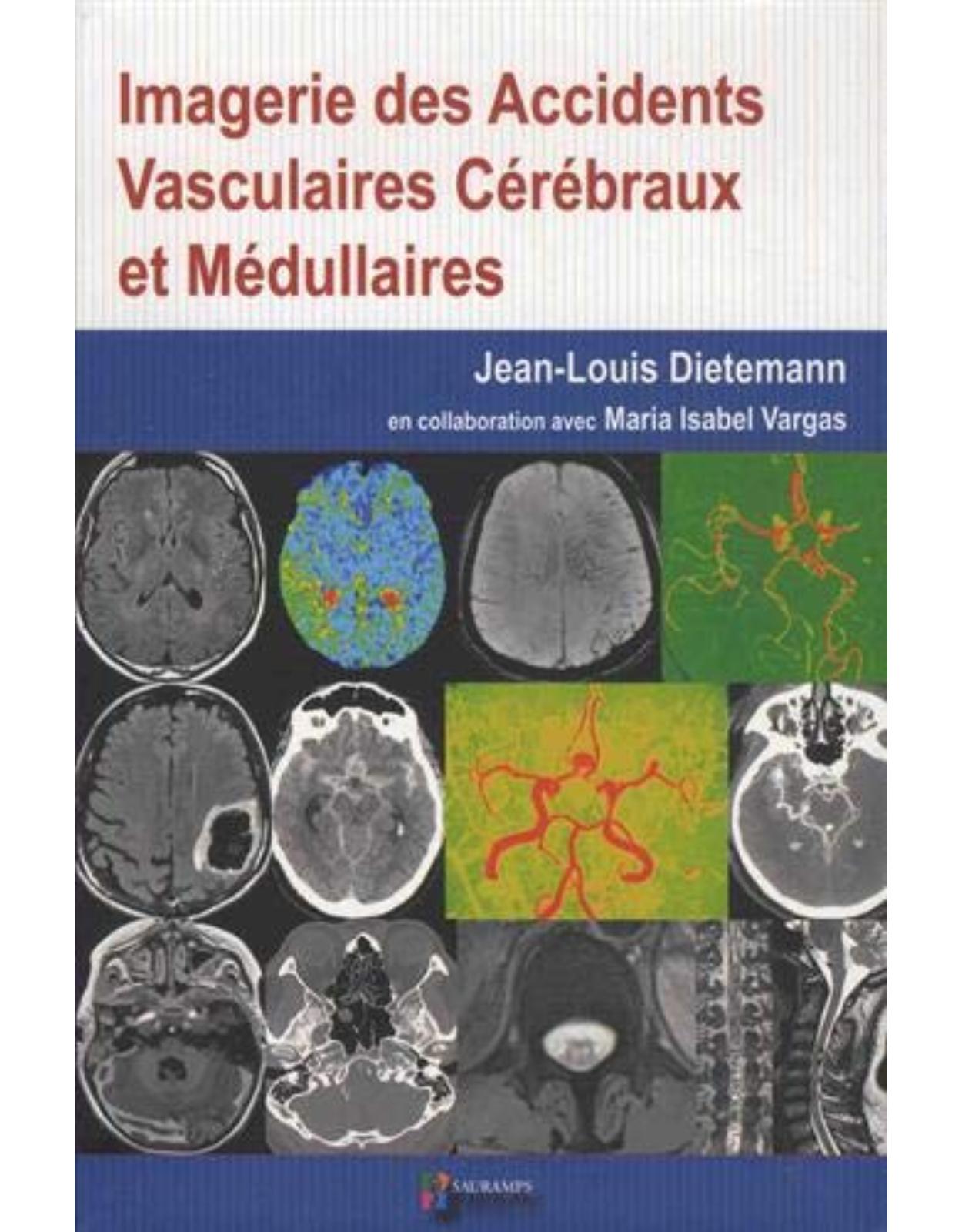 IMAGERIE DES ACCIDENTS VASCULAIRES CEREBRAUX ET MEDULLAIRES