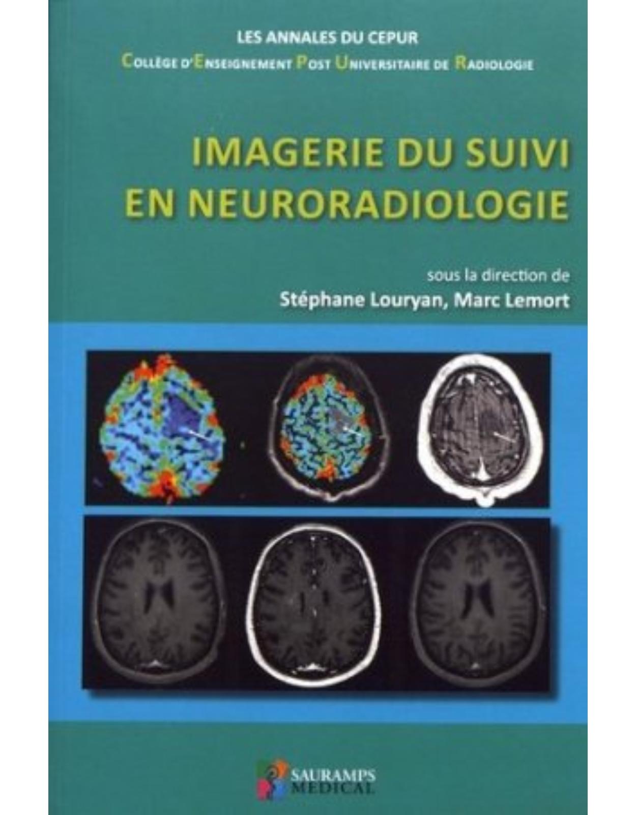 IMAGERIE DU SUIVI EN NEURORADIOLOGIE