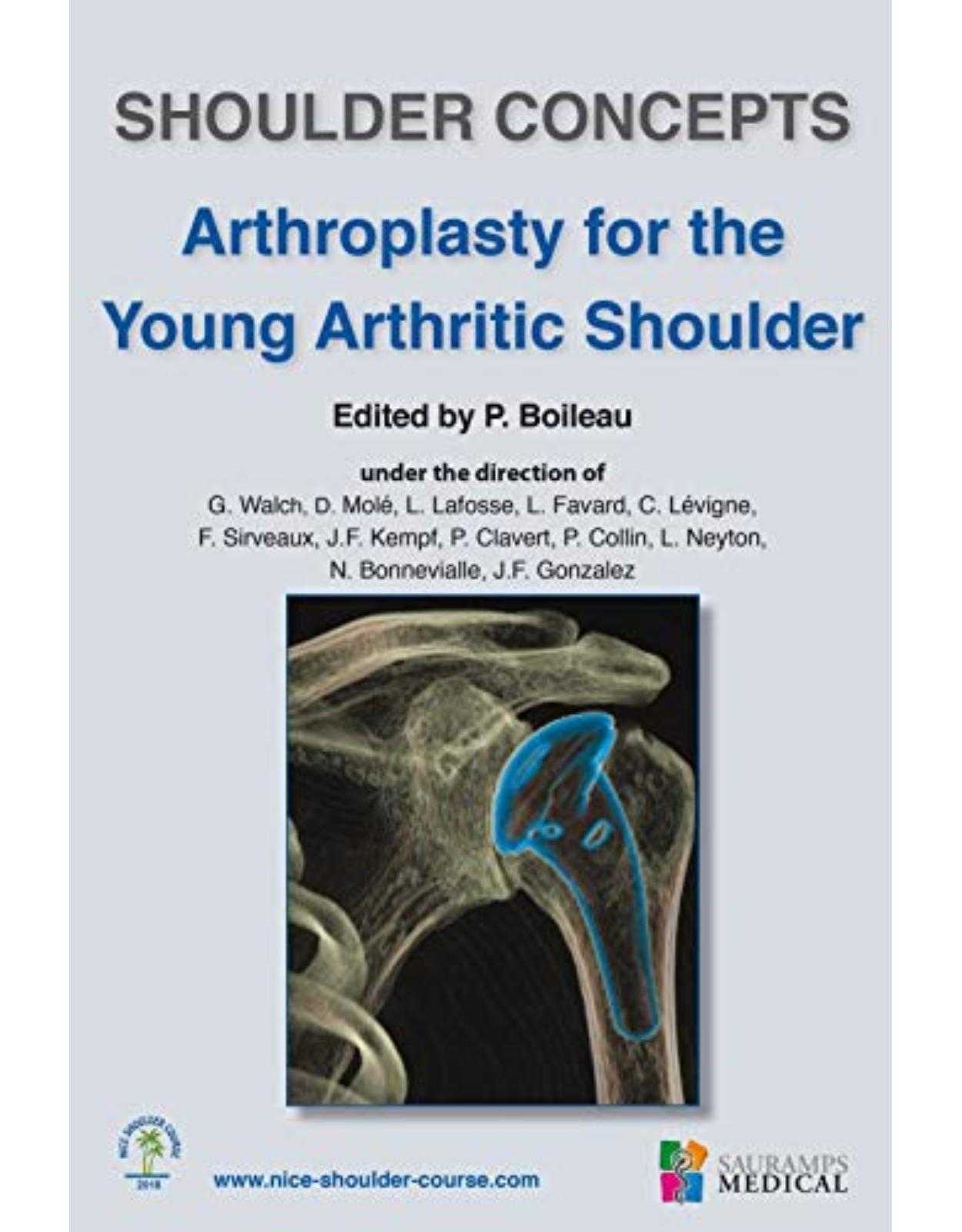 ARTHROPLASTY FOR THE YOUNG ARTHRITIC SHOULDER