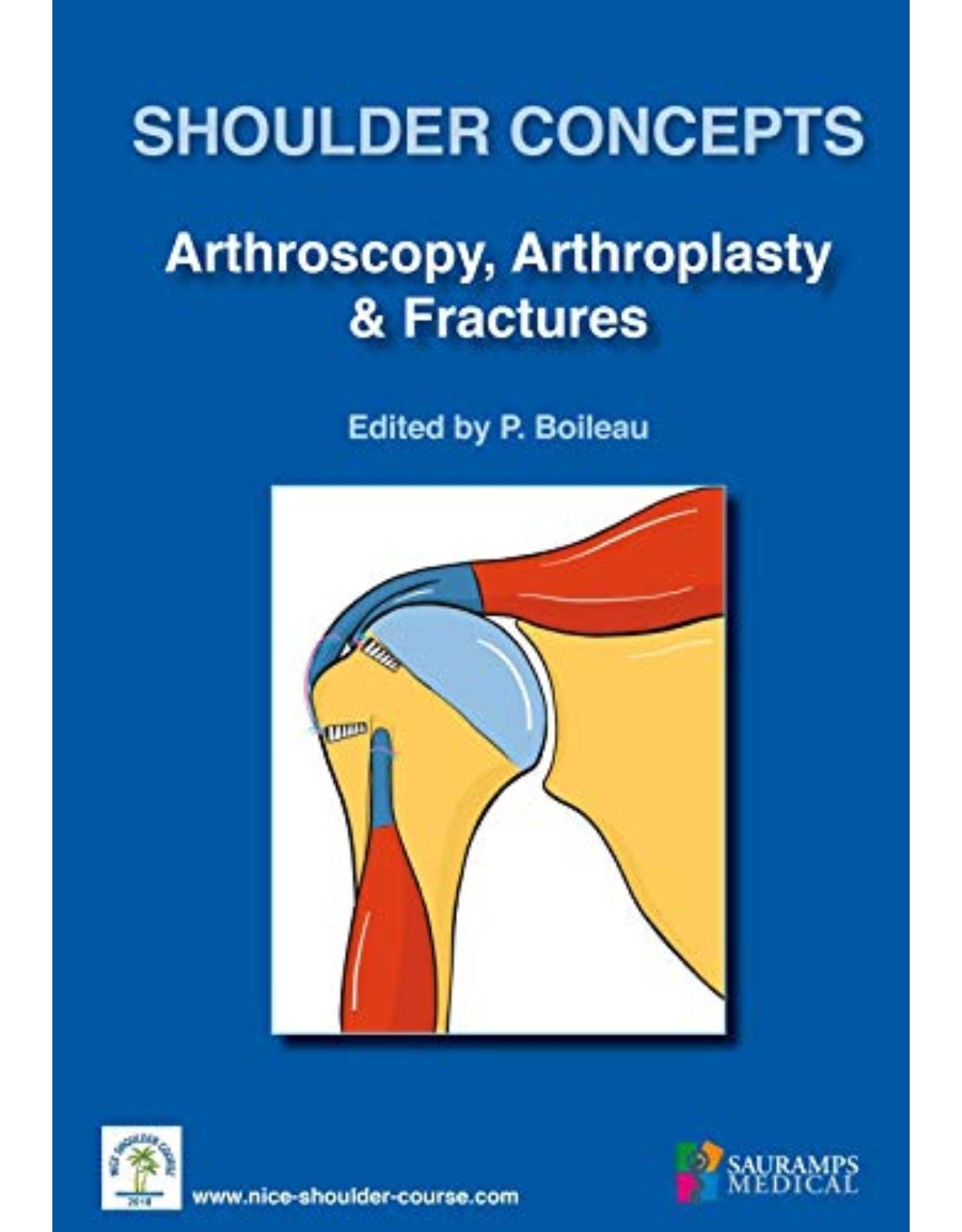 SHOULDER CONCEPTS ARTHROSCOPY, ARTHROSPLASTY & FRACTURES