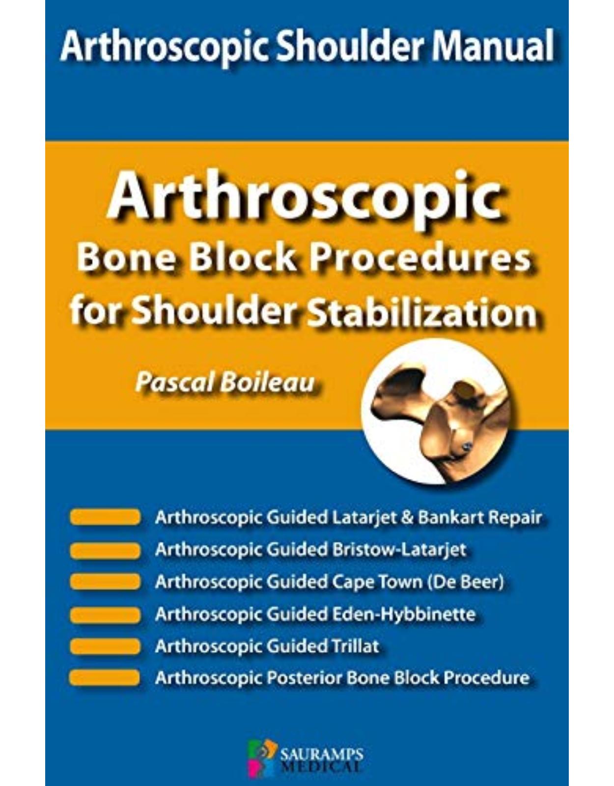 ARTHROSCOPIC BONE BLOCK PROCEDURES FOR SHOULDER STABILIZATION