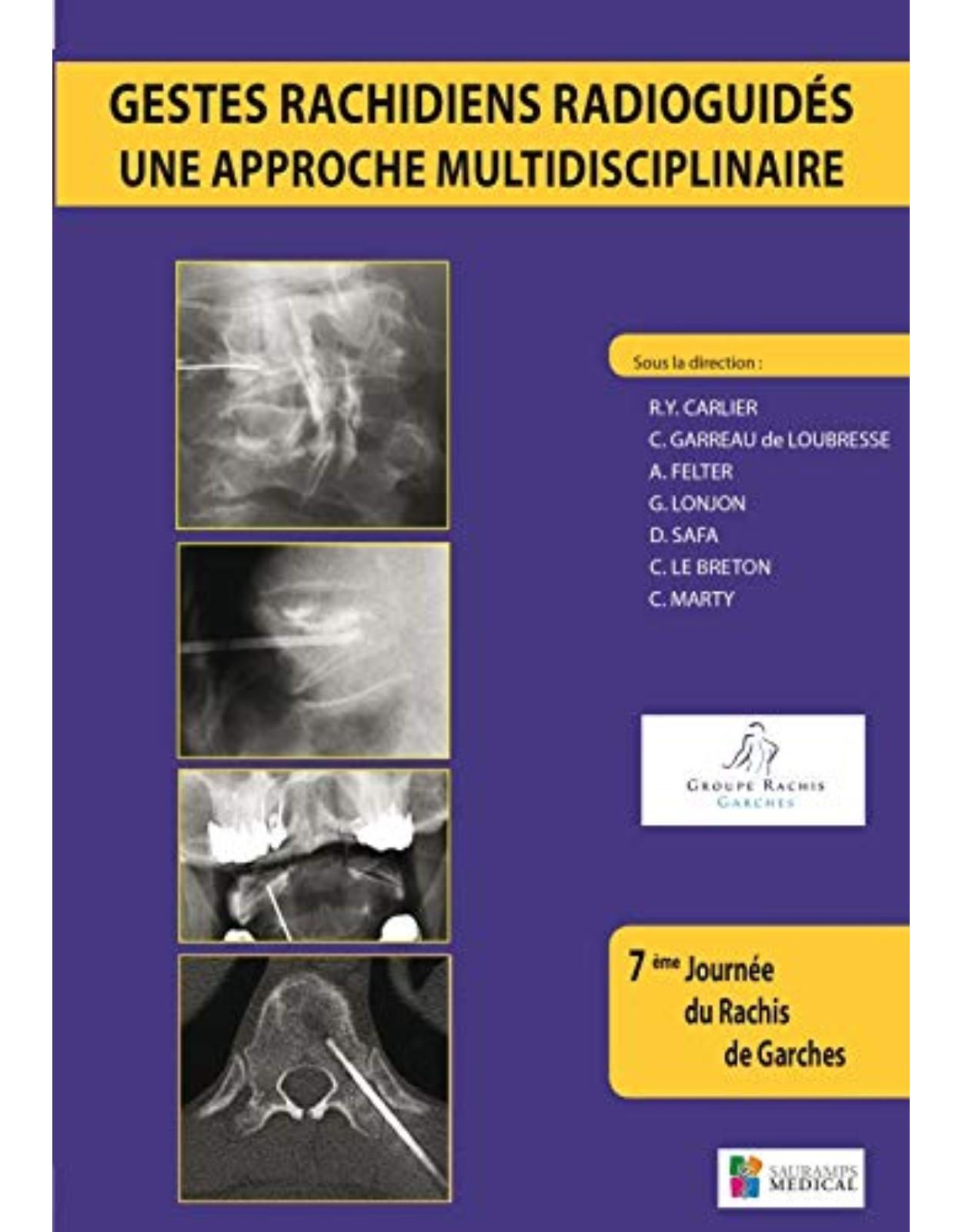 GESTES RACHIDIENS RADIOGUIDES - UNE APPROCHE MULTIDISCIPLINAIRE