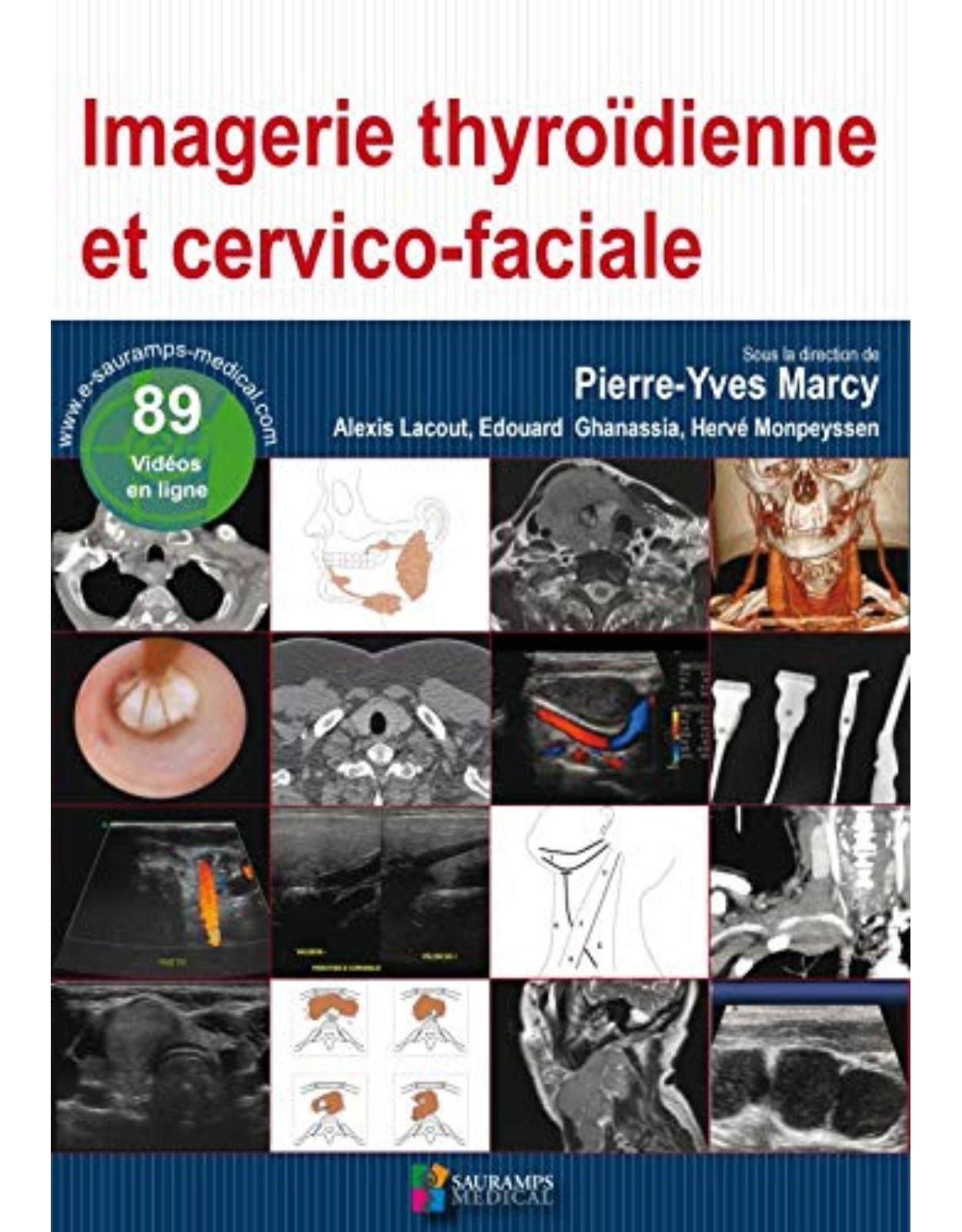 IMAGERIE THYROIDIENNE ET CERVICO-FACIALE