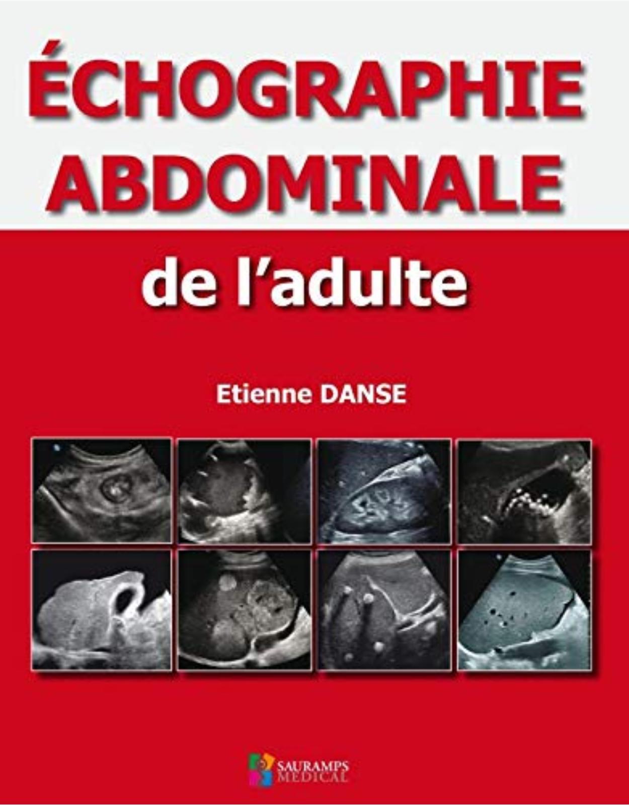 ECHOGRAPHIE ABDOMINALE DE L'ADULTE
