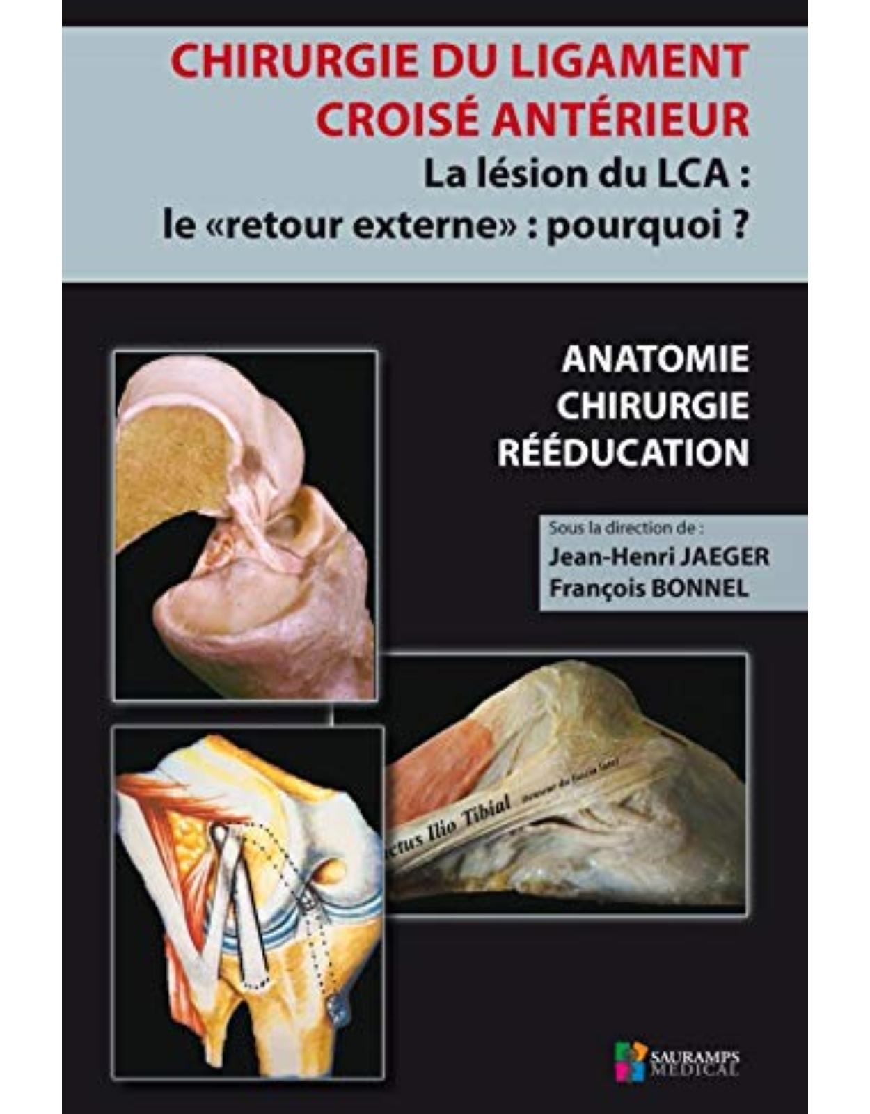 CHIRURGIE DU LIGAMENT CROISE ANTERIEUR DU GENOU